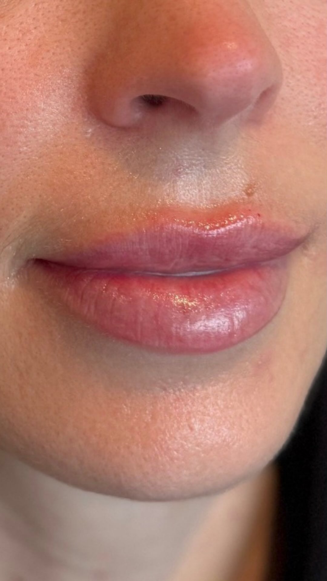 Feeling confident in your skin starts with a plan that’s made for you.🤍
At Enhanced by Darcie, we combine a personalised approach with evidence-based cosmetic treatments to help you work towards your skin and aesthetic goals.
If you’re ready to invest in yourself with guidance you can trust, we’d love to welcome you into the clinic.
Book a consultation to start your journey. 🔗