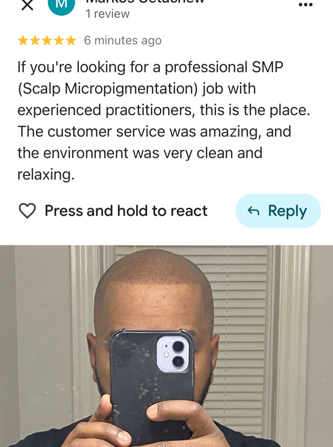❤️Ask yourself……. “If you could change it, would you?”
… message for your FREE consultation & your pricing!!
🏆2024 BEST SMP ARTIST (silver🥈) for ALL of 🇨🇦&🇺🇸
🏆2022 WINNER🥇- Best Alopecia (UK 🇬🇧)
🥇2021 Consumer Choice Awards- BEST HAIR RESTORATION
Over 500+ 5 ⭐️⭐️⭐️⭐️⭐️ Google Reviews✅
Scalp Micropigmentation is the 🌎worlds No.1 most natural & non-invasive solution for hair loss
👉Consultations are always FREE 👌and we take all the time you need to chat!
🏆 Ink2Scalp SMP Studios
www.ink2scalp.com/best-smp-studio
647-424-1186
🇨🇦 #naturalsmp #thinksmp #bestsmptoronto #micropigmentation #scalppigmentationtattoo