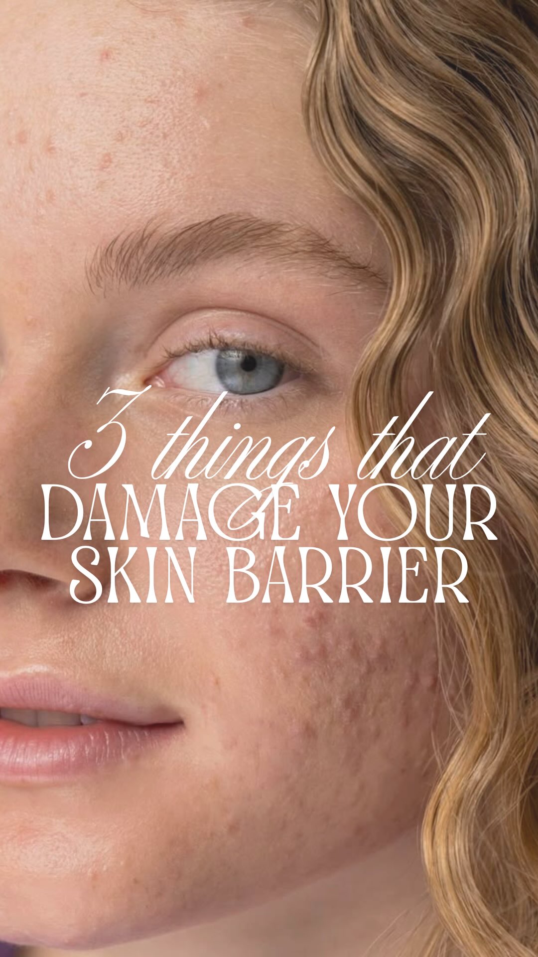 A healthy skin barrier means:
✨ Less sensitivity
✨ Better hydration
✨ Stronger protection against irritation and breakouts
✨ That healthy, glowing skin we all want
If your skin has been feeling tight, red, stinging, or suddenly reacting to products you’ve always used, your skin barrier might be asking for a little extra care.
💬 Which one surprised you the most?
#SkinBarrier #SkinBarrierRepair #HealthySkin #SensitiveSkin #SkincareTips