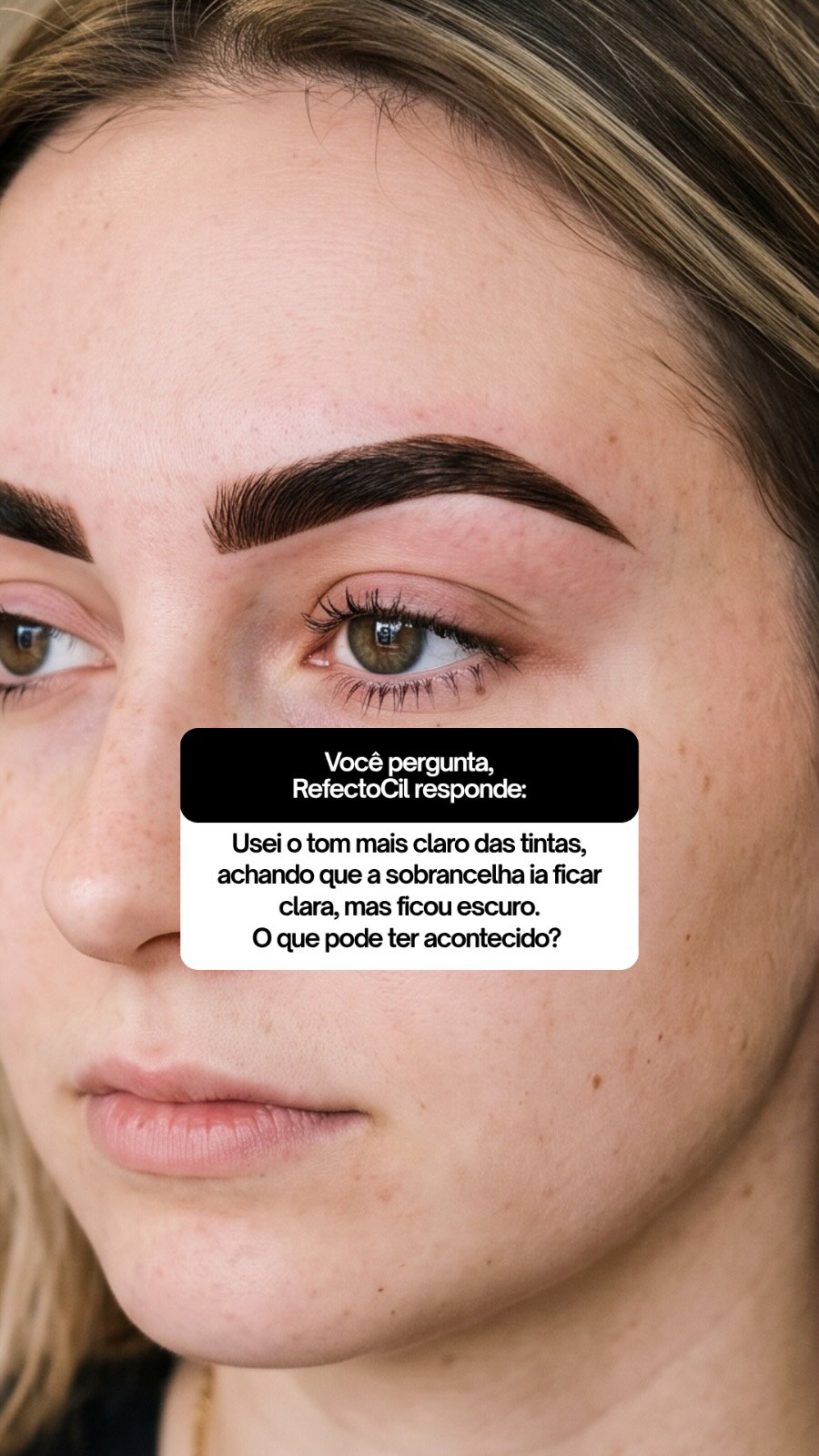 Usei a tinta mais clara, mas a sobrancelha ficou escura. O que deu errado?
Você Pergunta, a RefectoCil Responde!
E por que isso acontece? A coloração para sobrancelhas atua exclusivamente por deposição de pigmentos. Ou seja, ela não possui ação clareadora sobre a melanina já existente no fio.
Se a sua cliente apresenta pelos naturalmente escuros, essa base natural vai continuar ditando o resultado final. Por isso, aplicar a cor mais clara em um fio escuro não vai deixá-lo claro.
Quando o objetivo é reduzir a intensidade da cor ou entregar fios mais claros, você precisa do passo anterior: a descoloração.
É necessário descolorir para colorir!
Entender a fundo a interação entre a pigmentação natural do fio e a nova cor desejada com a tinta é o que separa a tentativa e erro de um resultado previsível e impecável.
Ficou com mais alguma dúvida? Deixe aqui nos comentários que a RefectoCil responde!
.
.
#refectocilbrasil #theworldinyoureyes #tinturadesobrancelhas #fiobranco #mordacagem
@academiarefectocil @refectocil_international