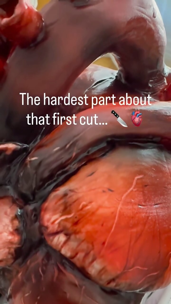 For a man whose life revolves around heart procedures right now 🩺🧑⚕️🥼🫀