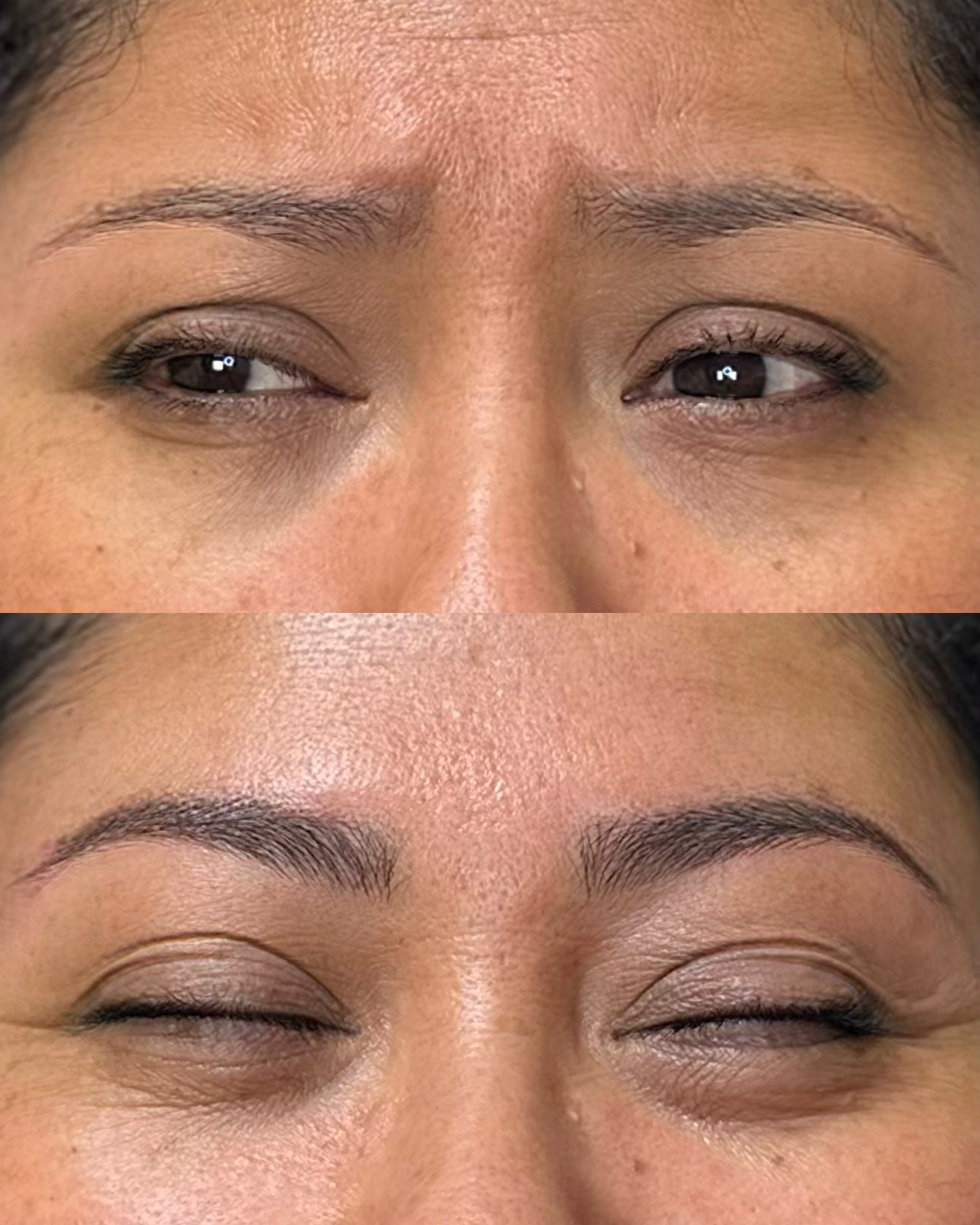 New brows can be life changing!
Especially for those of us suffering from hair loss or over tweezing.
Do you wish you could go back to the 90’s and
NOT tweeze your brows into pencil thin lines?
I don’t have a time machine, but I do have the magic of Microblading!
Benefits:
🪄fuller, natural looking brows I more defined shape
🪄long lasting results
🪄water proof/smudge proof
🪄no more drawing brows on
🔗 in bio to reserve your appointment
📲 813-215-0052
💻 www.archenvyeyebrow.com
📍6601 Memorial Hwy, Suite 116, TPA
#tampabrows #tampamicroblading #tampapermanentmakeup #nomore90sbrows