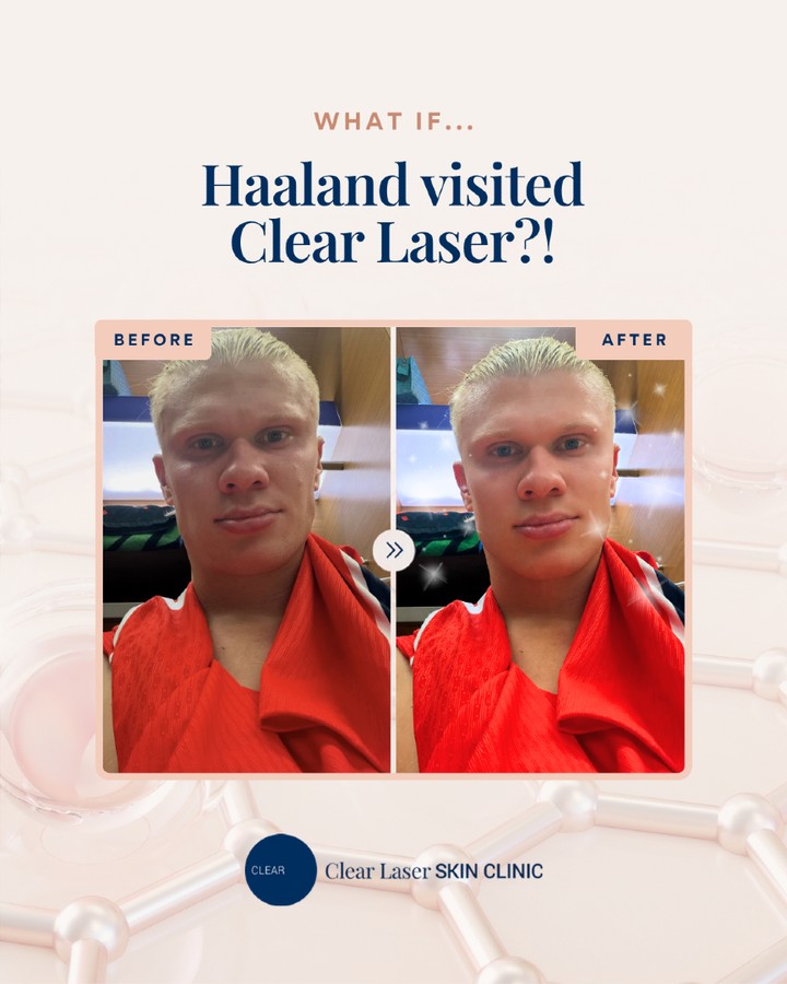 What if... Haaland was at Clear Laser?! 👀
#ClearLaserSKINCLINIC #XERF #UltherapyPRIME #Juvelook #Lifting #KBeauty #SkinRejuvenation #AntiAging #GlowUp #MedicalAesthetics