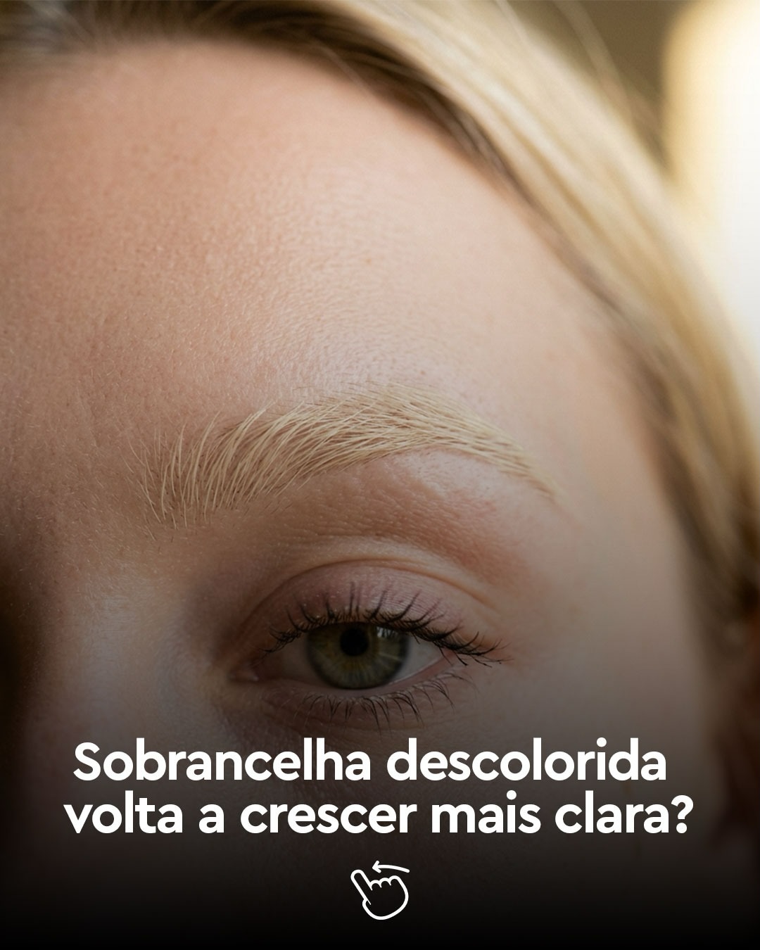 A resposta é não e é importante entender o porquê!
A descoloração age apenas nos fios que já existem na sobrancelha, o que ela faz é clarear a cor atual desses fios.
Os novos fios que vão nascer depois do procedimento crescem com a cor natural da sobrancelha, que é determinada pela genética de cada pessoa.
Isso significa que com o tempo, o fio vai crescer, a raiz vai aparecer mais escura que as pontas e é aí que entra a importância de alinhar essa realidade com a cliente antes do procedimento.
Quando a cliente entende como o produto funciona, ela sai satisfeita e volta no tempo certo para manutenção do procedimento.
Você costuma explicar isso antes de descolorir?
.
.
#refectocilbrasil #theworldinyoureyes #tinturadesobrancelhas #descoloracaodesobrancelhas #sobrancelhadescolorida
@academiarefectocil @refectocilcolombia, @refectocilperu, @refectocilchile, @refectocilecuador @refectocil_international