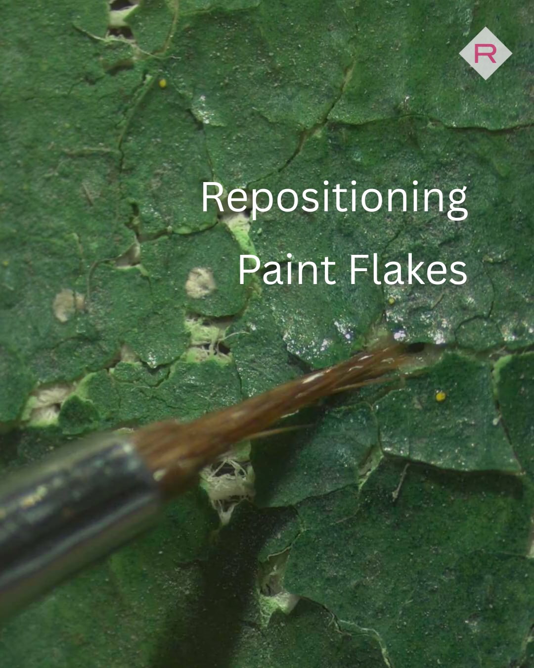 When paint starts to lift or curl away from the surface, it must be carefully repositioned before the painting can be consolidated.
For example, this painting had severe flaking and cupping. Working under magnification with a microscope, the conservator carefully guides each displaced paint flake back into place. A small amount of adhesive is then applied to temporarily secure the flakes before the final consolidation treatment.
These precise interventions are essential to preserving the painting and its original surface.
#ArtConservation #PaintingConservation #ConservationScience #CulturalHeritage #CollectionsCare