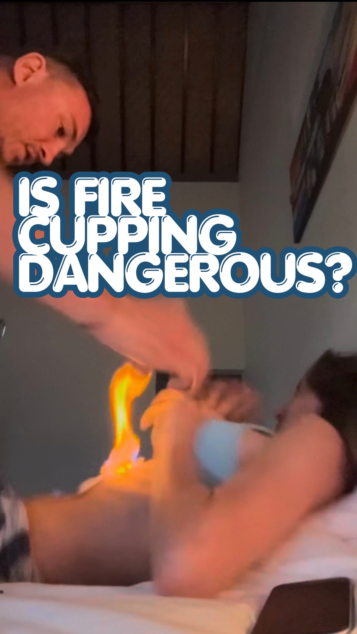 New bodymaxxxing hype cupping technique… turn that innie belly button into an outie! 😳 I have seen multiple moxibustion burns from patients coming in where the moxa was left on them too long or falls off its holder. Why play with fire when you don’t know the pressure or the depth? Sure it’s warm, but if you wanna get heat get the body moving! Level up with science for the ability to avoid this kind of stuff and be more objective 🤓 WHAT the CUP