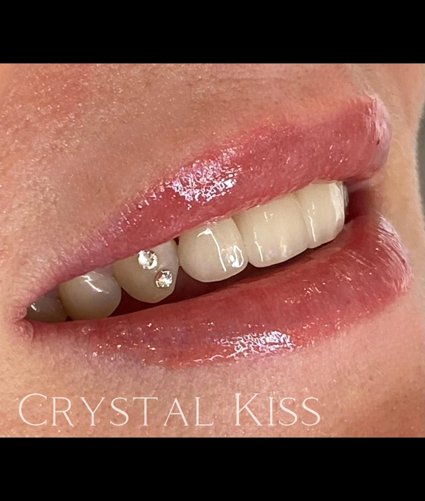 Double the crystals, double the confidence ππ
not just a smile, it's a whole mood β¨ two gems, one flex
This look is giving main character energy with just enough glam gloss to seal the deal. If your smile isn't turning heads yet, that's on you, babe. Book your appointment and let's fix that.
π 2588A Yonge St, Suite #106 (2nd Floor), Toronto
π MonβFri, 9AMβ6PM EST
π§ crystalkiss.toronto@gmail.com
π www.crystalkiss.ca
#toothjewelry #CrystalKissToothGems #swarovskicrystal #smiles