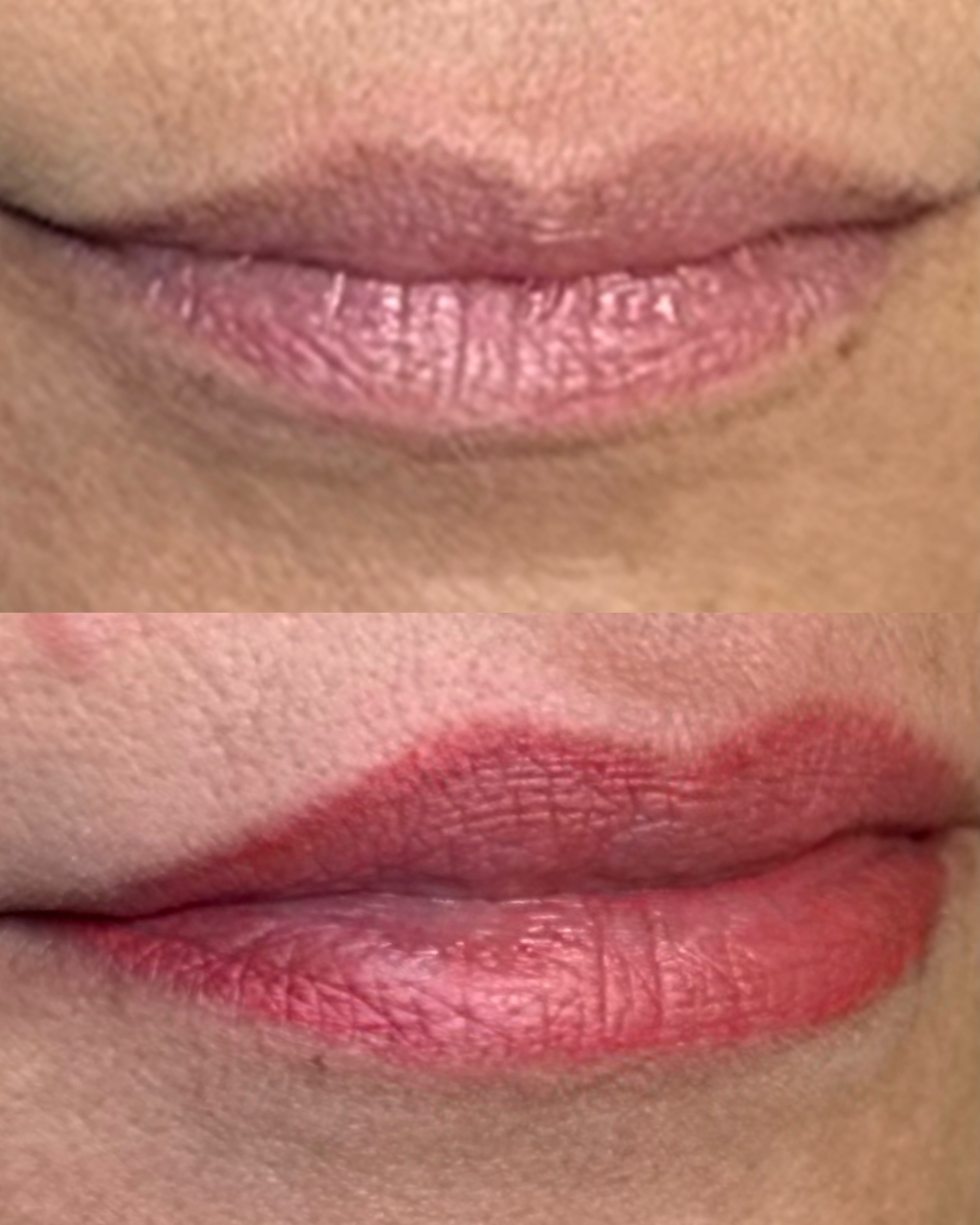 💋 Lip Blushing Myth vs. Reality 💋
One of the biggest misconceptions about lip blushing is that it’s meant to replace lipstick. It isn’t!
Lip blushing is designed to restore what time naturally takes away. As we age, our lips often lose pigment, become paler, and the borders can start to fade, making lips appear smaller and less defined.
Lip blushing gently enhances your natural lip color, restores definition to the lip border, and adds a healthy, youthful looking flush of color.
Think of it as waking up with your lips looking fresher, more vibrant, and more alive, not like you’re wearing a full coat of lipstick.
The result?
Naturally enhanced lips that look healthy and youthful, whether you’re makeup free at the gym, lounging by the pool, or headed out for date night.
Book your lip, blush consultation today to take advantage of our summer special!
🔗 in bio to reserve your appointment
📲 813-215-0052
💻 www.archenvyeyebrow.com
📍6601 Memorial Hwy, Suite 116, TPA
#tampapermanentmakeup #tampalips #tampalipblush #busymomlife