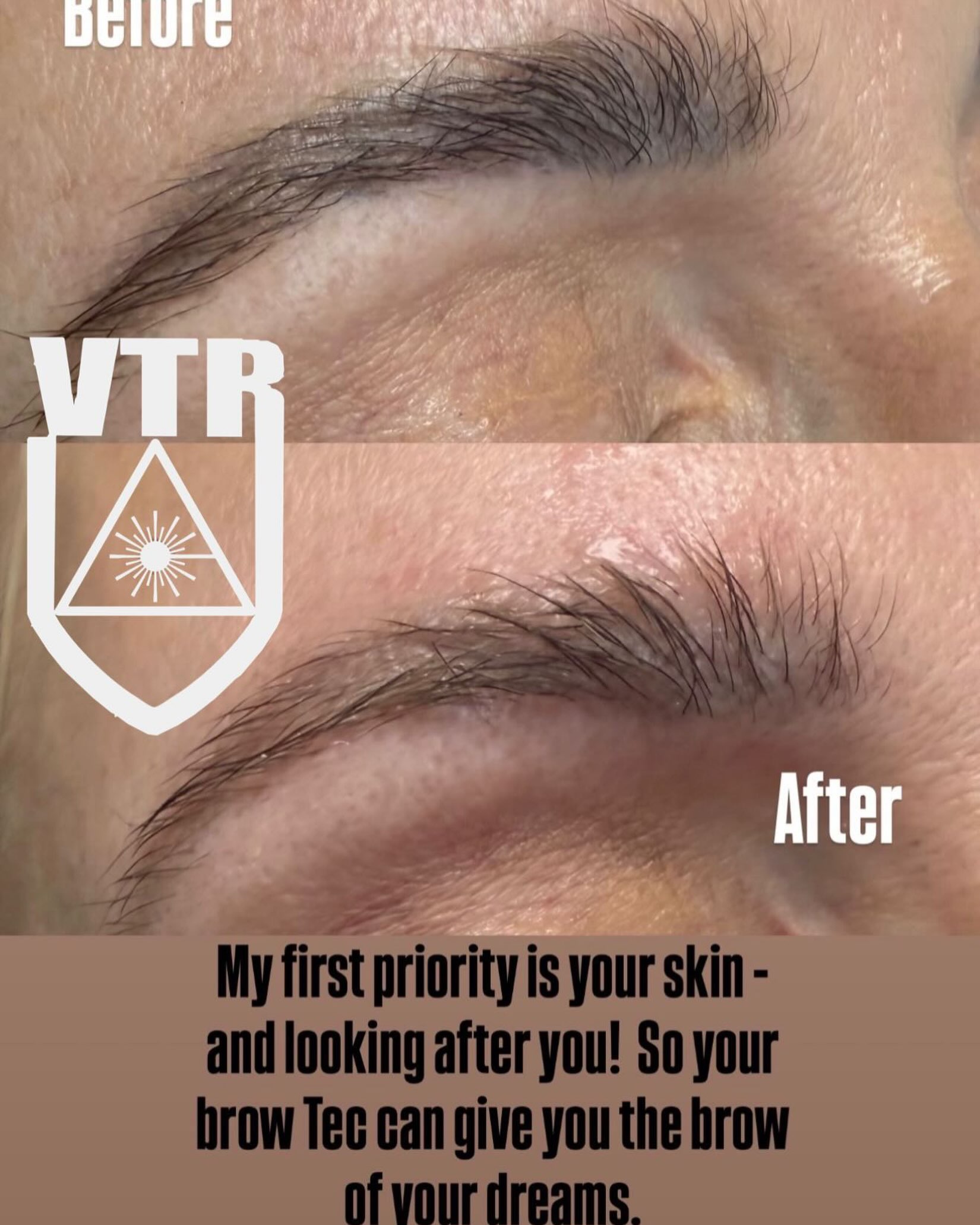 Our first priority is your looking after your skin! Safe -Gentle-Results keeping the integrity of your skin is our first priority!