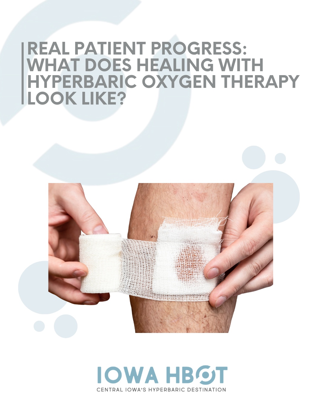 One of the first questions we hear is: "When will I start seeing results?"
The truth is, healing begins long before it's visible. Hyperbaric Oxygen Therapy works beneath the surface by flooding damaged tissue with oxygen, helping your body repair itself one treatment at a time.
Every session helps support:
✔️ Increased oxygen delivery
✔️ Reduced inflammation
✔️ New blood vessel growth
✔️ Collagen production
✔️ Tissue regeneration
If you or a loved one is dealing with a chronic wound, diabetic foot ulcer, radiation injury, or another condition that isn't healing as expected, HBOT may be the missing piece.
Read our newest blog to learn what to expect during treatment and why healing with HBOT is a gradual, science-backed process 👉 https://www.iowahbot.com/post/real-patient-progress-what-does-healing-with-hyperbaric-oxygen-therapy-look-like
Call 515-421-4018 to schedule your complimentary consultation and find out if HBOT is right for you.
#HyperbaricOxygenTherapy #HBOT #WoundHealing #ChronicWounds #DiabeticFootUlcer #AdvancedWoundCare #HealingJourney #RegenerativeMedicine #TissueRepair #OxygenTherapy #IowaHBOT #DesMoines #CentralIowaHealth #Healing #Wellness