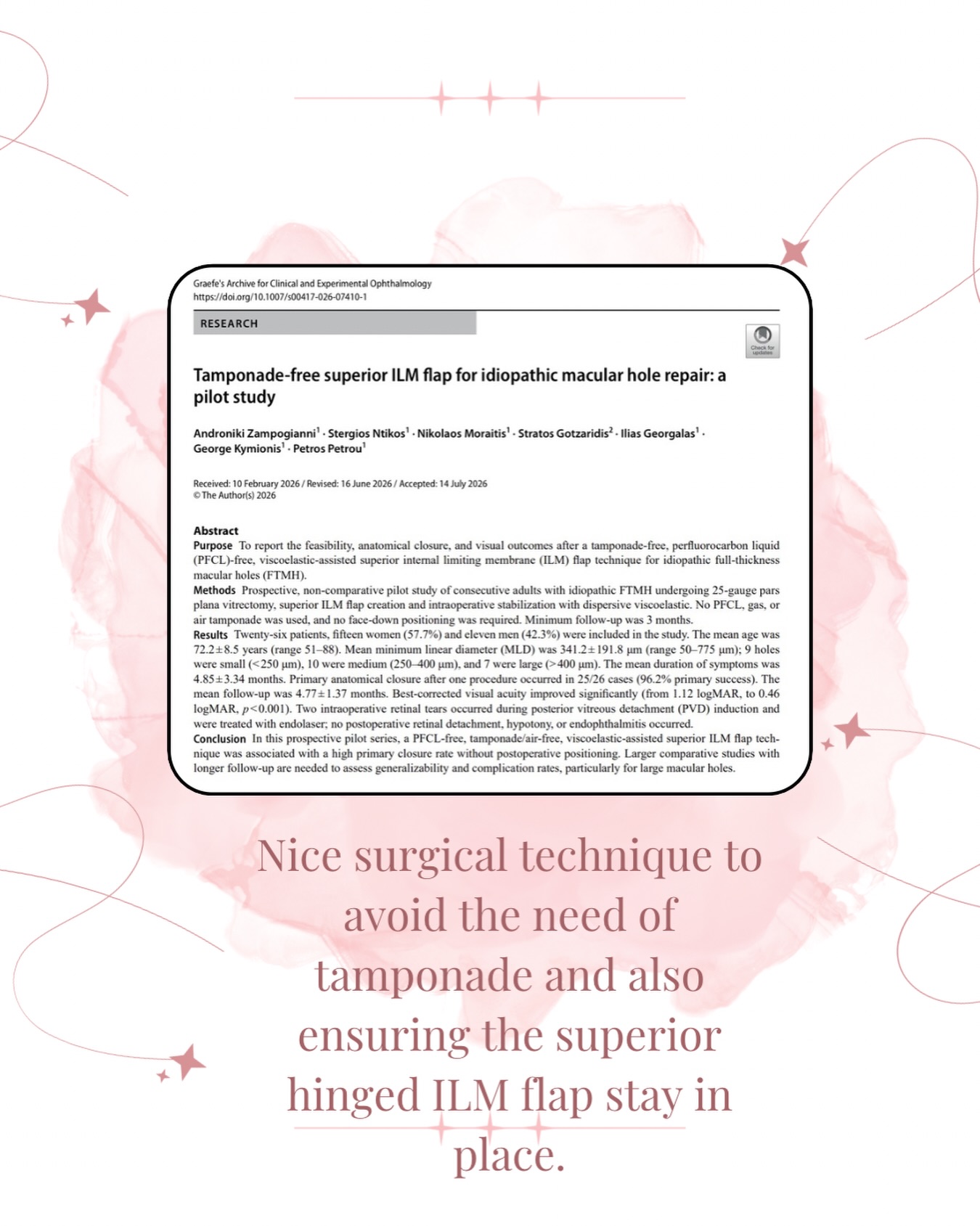 Interesting surgical technique where a limited superior hinged ILM flap is created and the flap is folded over the hole. To keep the flap in place:
- Turn infusion OFF
- Wait for fluid currents to stop
- Inject Viscoat
- Viscoat holds the flap against the hole
More importantly, no need for PFCL, air-fluid exchange, gas, silicone oil or patient posturing. Only need to avoid strenuous activity for 5 days.
Full video and open access paper available at:
Zampogianni A, Ntikos S, Moraitis N, Gotzaridis S, Georgalas I, Kymionis G, et al. Tamponade-free superior ILM flap for idiopathic macular hole repair: a pilot study. Graefes Arch Clin Exp Ophthalmol. 2026. doi:10.1007/s00417-026-07410-1.
#macularhole #vitreoretinalsurgery #surgicaltechnique #ophthalmology #eyedoctorchng