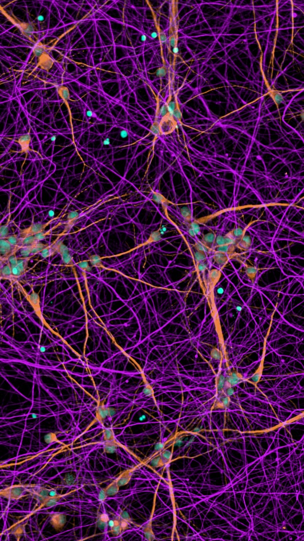 What an amazing week at #ISSCR2026 🧠🧬✨ Thank you to everyone who stopped by our posters, connected with us, or shared a drink during networking time. Science, community, and good conversations — can’t ask for more! See you next year 👋
#iPSC #neuroscience #conference #stemcells scicomm