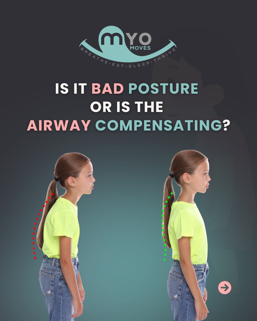 Bad posture is almost never just bad posture.
Your body is smart. When breathing gets restricted, it adapts with a forward head, rounded shoulders, tilted pelvis, all of it. These aren’t habits, they are compensations.
💬 Comment GUIDANCE to find out what your posture is telling you with a Clinical Evaluation
.
#myofunctionaltherapy #airwayhealth #posture #mouthbreathing #myo