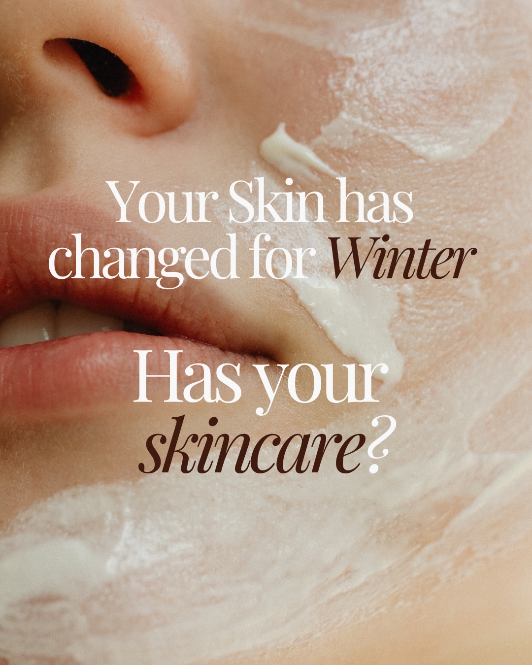 Dry skin this winter?
What are you doing to help it?
Did you know our skin does actually change during winter months. It’s not you imagining it.
It gets dry, dull and flakey.
Fine lines appear more noticeable, makeup doesn’t sit right and you may not know it but the skin barrier weakens which can lead to sensitivity and slow recovery.
Which is why it’s so important to hydrate the skin and support the barrier during the colder months.
Read through to see how you can support your skin with a few swapsies this winter.
If you don’t have any of these products, they are all available in clinic to purchase.
We offer try me kits & starter packs if you’re hesitant in switching over to medical grade skin care.
And we have Suzy on hand to consult or give any advice or help you may need regarding your skin & products.
Send us a message now if you have any questions
#aspectdr #aspectskincare #winterskincare #skincareroutine #brisbaneskinclinic