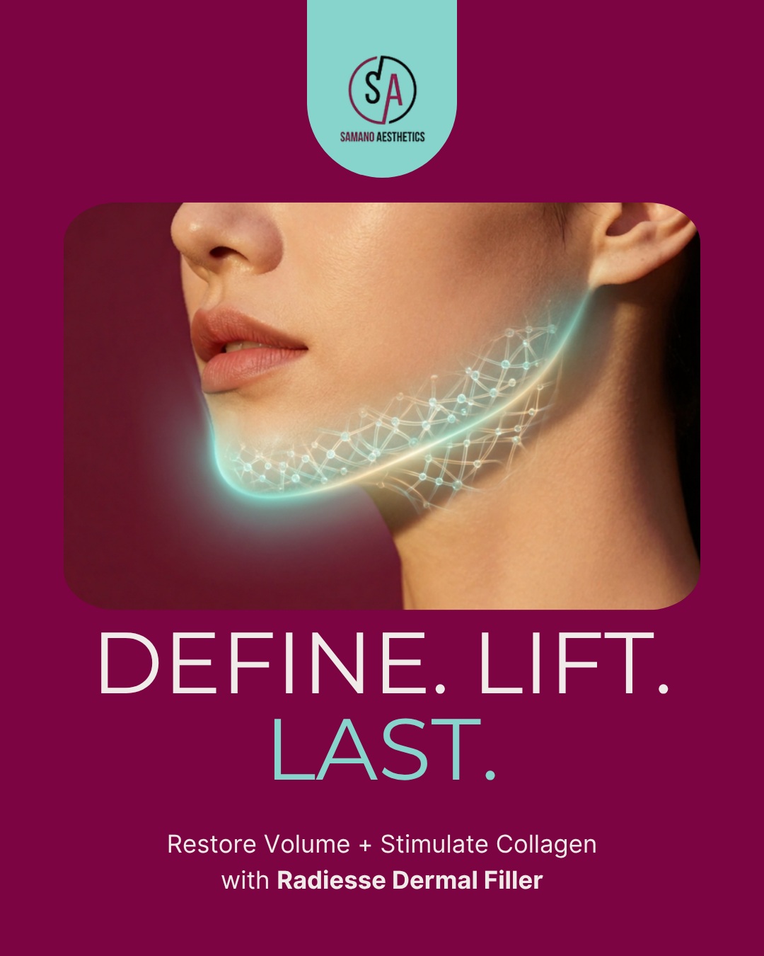 Define, lift, and last—without the waiting period. 🤍
Unlike standard biostimulators that require multiple sessions and up to 6 months to display noticeable changes, Radiesse® works immediately:
✅ Immediate Volume: Calcium hydroxylapatite microspheres provide instant structure and contour upon injection.
✅ Collagen Stimulation: As the gel carrier is absorbed, your body naturally builds new collagen around the microspheres.
✅ Long-Lasting Results: Enjoy your refreshed look for 12–18 months as your own collagen maintains the lift.
Ready to refresh your look?
📲 Call us at (407) 790-4020 to book your appointment today.
#SamanoAesthetics #Radiesse #DermalFillers #Biostimulator #CollagenBoost #FacialContouring