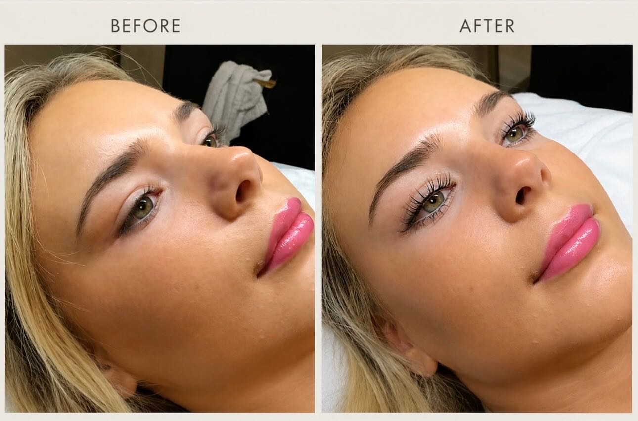 The before & after speaks for itself. ✨
A lash lift + tint gives your natural lashes a beautiful curl, added definition, and the appearance of extra length, all while keeping the look soft and natural.
#LashTransformation #LashLift #LashTint #NaturalLashes #BeautyResults