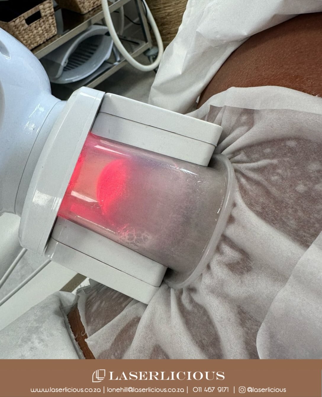 Body contouring is a journey - not a last-minute decision.
CoolTech Cryolipolysis targets stubborn fat pockets using controlled cooling, allowing your body to naturally eliminate treated fat cells over time.
Start now, and let your results develop as the seasons change.
📞 Call Laserlicious on 011 467 9171 / WhatsApp 083 490 9524 / info@laserlicious.co.za to make a booking today.