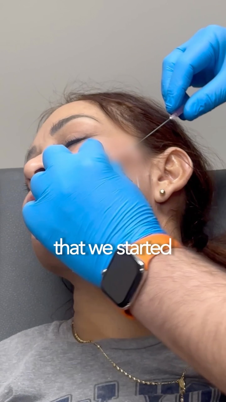 The only patient acquisition team built to bring aesthetic clinics Thread Lift appointments.
That’s how Brooke’s clinic generated an additional $50,000 in revenue in her first 2 months with us.
Month 1: +$20,000
Month 2: +$30,000
Most patient acquisition companies know how to generate Botox and filler leads.
We built a system specifically for the higher-value treatments most clinics struggle to keep consistently booked.
Because getting someone to book a $3,000+ Thread Lift or Non-Surgical Facelift is completely different from getting someone through the door for Botox.
That’s why we created the Trusted Clinic Protocol.
We identify the premium treatment with the biggest revenue opportunity inside the clinic.
We position it around the transformation patients actually want, not discounts.
We build trust around the clinic, practitioner and treatment before the patient enquires.
And then we turn that demand into qualified appointments from patients specifically interested in that premium treatment.
For Brooke, that meant bookings started coming through almost immediately.
And within her first 60 days:
+$50,000 in additional clinic revenue.
If your clinic performs Thread Lifts but you’re still relying predominantly on Botox and filler to keep the calendar full, there’s a much bigger opportunity sitting inside your clinic.
DM me “DEMO” and I’ll show you how the Trusted Clinic Protocol works.