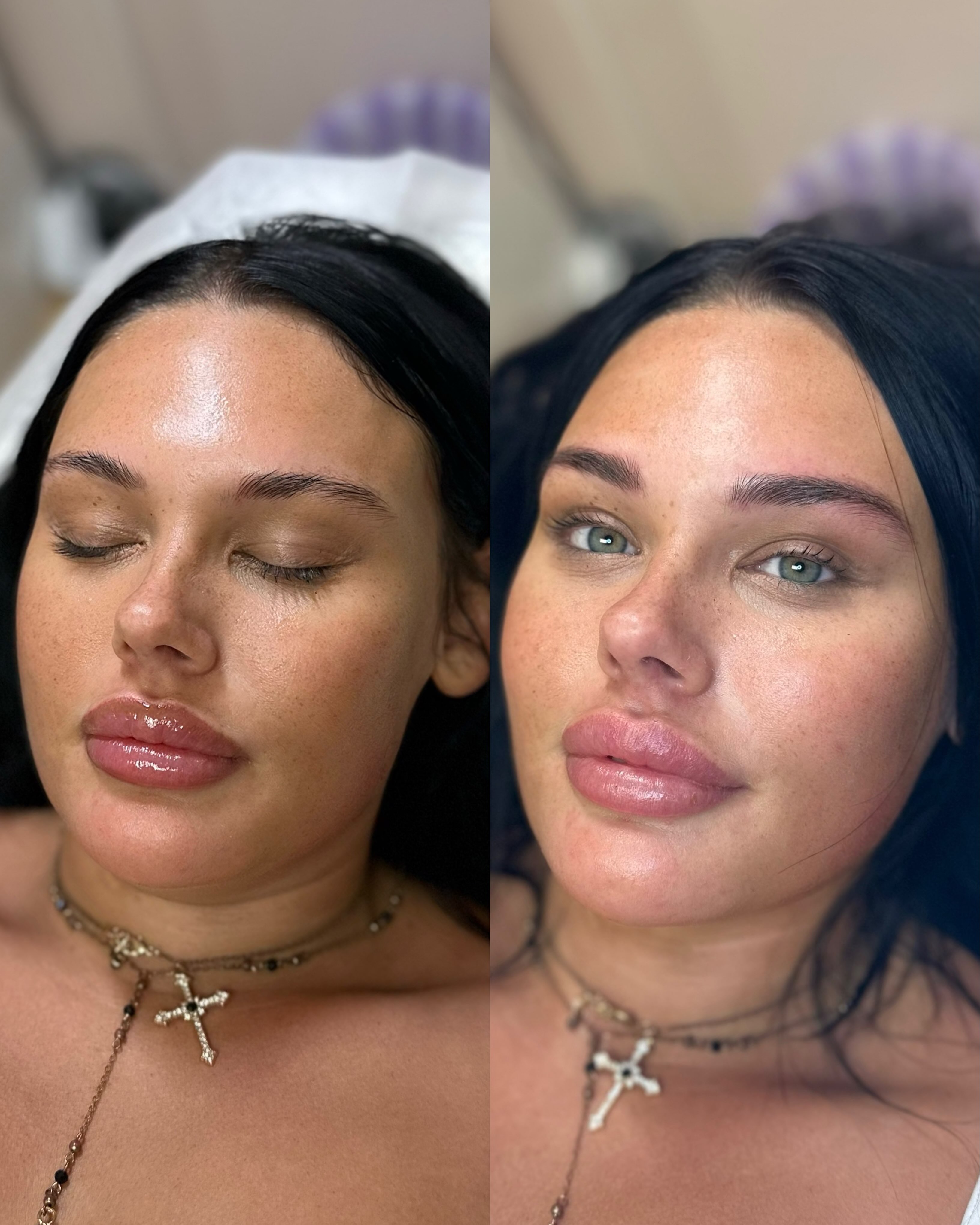 Can we talk about something?
Most people looking at your before photo don’t notice what’s missing.
But they absolutely notice the difference in the after!
Not because the brows are bigger.
Not because they’re dramatic.
Because your entire face suddenly looks more balanced and
complete.
That’s the power of the right brow shape.
Soft. Natural. Customized.
🔗 in bio to reserve your appointment
📲 813-215-0052
💻 www.archenvyeyebrow.com
📍6601 Memorial Hwy, Suite 116, TPA
#tampamicroblading #tampabrows #tampapermanentmakeup