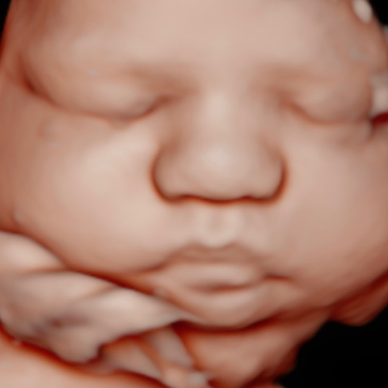 Friday mood! Look at this lil 38-week chunker 🥰
Mom texted me last week saying she hadn’t gotten any good pictures of baby throughout this pregnancy. Since she’s already 38 weeks with an anterior placenta, she wasn’t sure what we’d be able to see.
I told her every 4D/5D ultrasound is different and baby really runs the show, but there was still a chance we could get some pictures. I said, “I got you! Drink some extra water for the next few days and let’s see what baby gives us.”
And BAM… a whole full-on photo shoot 😍📸
Home birth and gender 🤫 everyone is waiting to meet the newest addition!! 🥰🥰