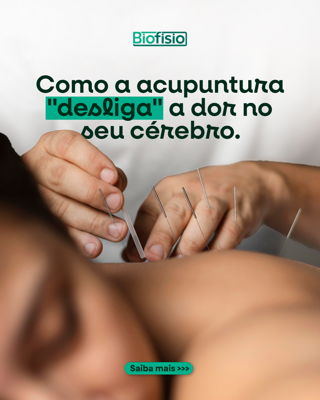 A agulha entra num ponto, mas o efeito acontece em outro lugar: no seu sistema nervoso. Entenda como a acupuntura influencia a forma como o cérebro processa a dor.
Já teve curiosidade sobre como isso funciona? Comenta aqui embaixo, ou fale com a Biofisio e agende sua sessão.
(11) 2468-1675
biofisio.com.br
Avenida Esperança, 237
Centro - Guarulhos - SP
📍 Estacionamento no local. Consulte valores!
#fisioterapia #acupuntura #neurofisiologia #manejodador #biofisio