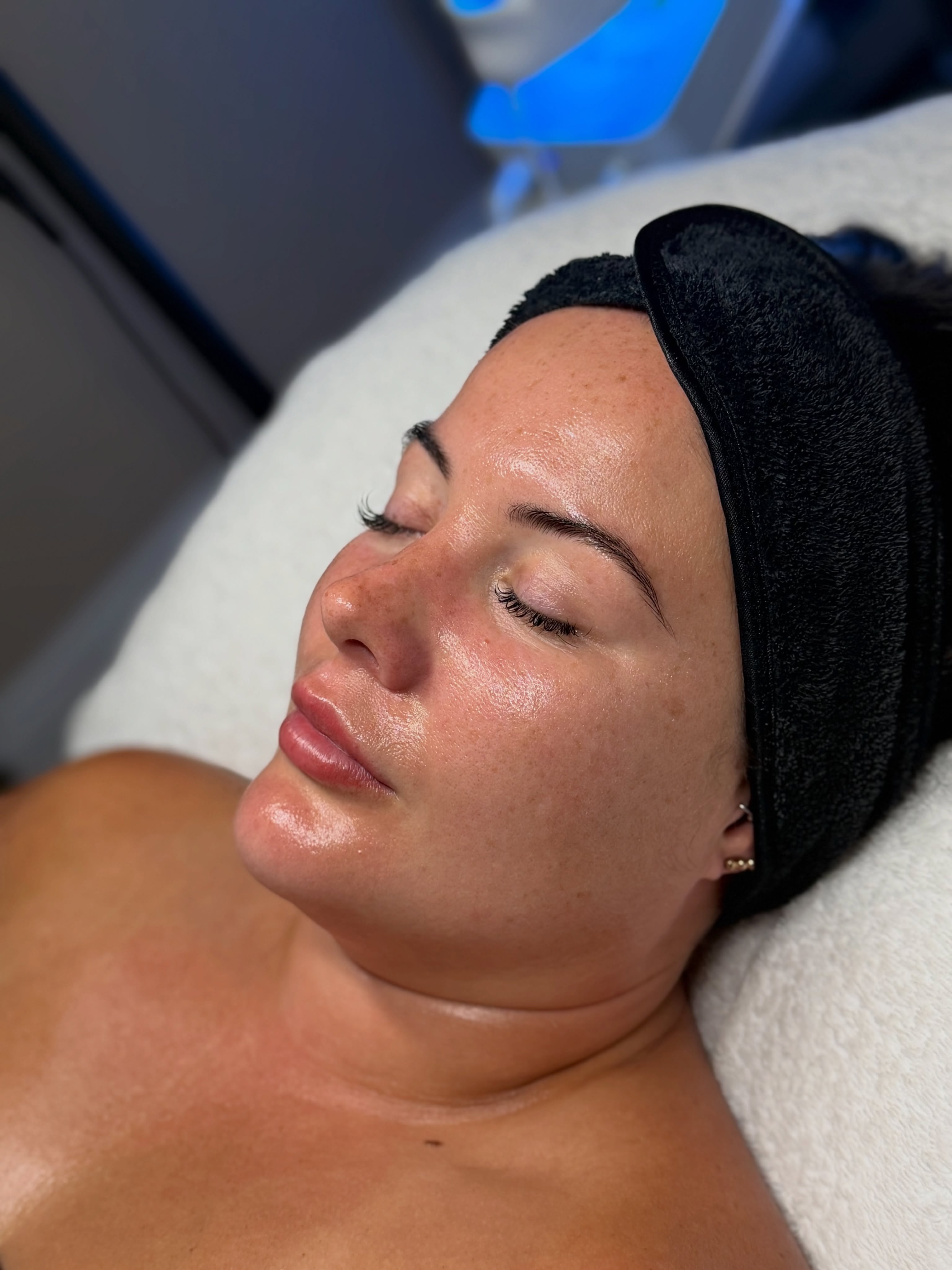 Nothing beats that @isclinical_uk glow ✨
Skin is hydrated, soothed and rejuvenated following a foaming enzyme treatment. With the use of pharmaceutical grade skincare we’re able to deliver skin results at a cellular level, leaving skin with more intense improvements than cosmetic grade
#isclinical #isclinicaluk #glowyskin #medicalgradefacials #foamingenzyme