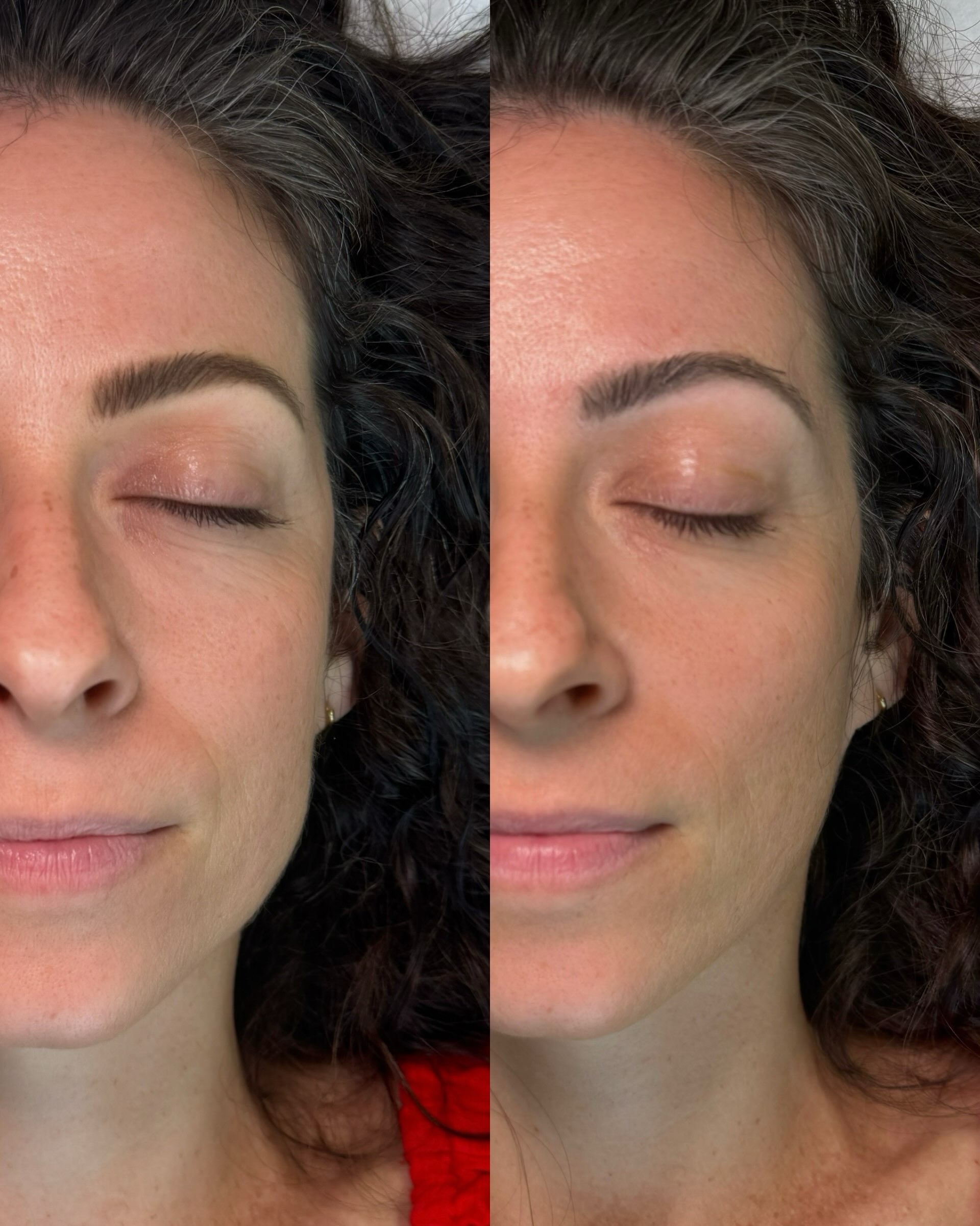 Freshly Tattooed vs 2 Years Healed
It’s important to understand the whole journey when you’re considering doing something permanent to your brows. Most people just get excited about what they look like the day they’re finished but you also have to love what they look like years later without a touch-up too! I. Haley’s case, she had a tough shaped tweezed into her brow and the tattoo (fresh or faded) helps to hide that and from a speaking distance, you can’t see the areas where she’s missing hair, which is more flattering and youthful.
Touch-ups should ONLY be done when 50% of the pigment has faded away (for oily skin that’s usually in 12-15 month, normal skin can be 18-24 months and dry skin clients can go 36+ months). If your artist is offering touch-ups every few months, it’s a money grab OR they aren’t experienced enough to get the depth right - either way, don’t do it! Adding too much pigment, too often will cause the brows to look blue and that is only fixable with a very expensive laser treatment. Don’t say you weren’t warned!
I’ve been doing brows since 2006 and tattooing brows since 2015… even if you don’t come to me, I’m happy to answer your questions and share my knowledge with you so drop any questions below 👇🏼