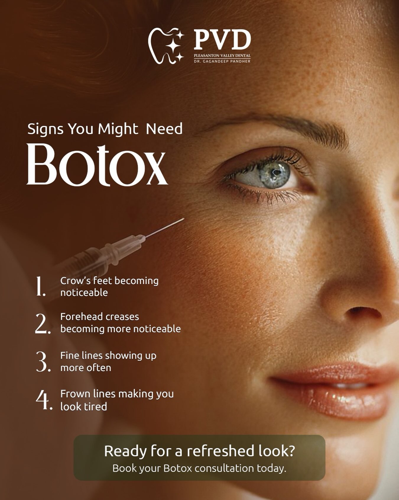 Think you might need Botox?
Here are a few signs to look out for. ✨
Fine lines, expression lines, or wrinkles that linger even when your face is relaxed? It might be time for a little refresh.
#botox #dentalclinic #dentist #pleasanton #pvd