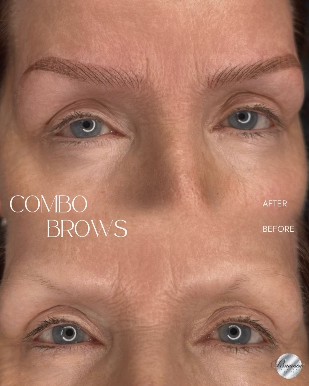 A little brow transformation, a whole new look 🤍
Before, her brows were very light and sparse, which made her difficult to draw balanced shape with brow pencil.
With Combo Brows, we added subtle definition, while following her natural brow structure. The result is a cleaner shape, balanced proportions and beautifully framed eyes✨
Do you like our transformation? Share in comments 🤍⬇️
_________________________________
Permanent Makeup Services,
Tattoo Removal & Carbon Laser Facial
⬆️Book apt with the link in bio
✨Free Consultation available
📍Oshawa, Ontario
✉️browsbyieva@gmail.com
☎️416-804-6749
Website:
permanentbeautybyieva.com
#nanobrowsoshawa #ombrebrowsoshawa #oshawabrows #whitbypermanentmakeup #whitbybrows