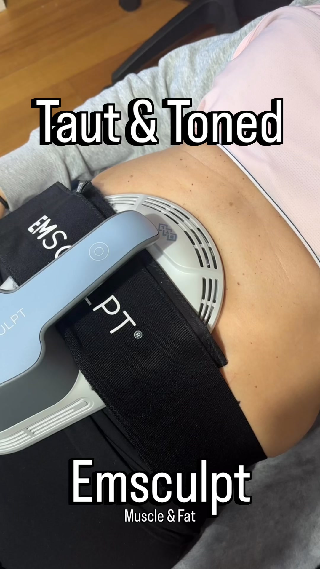Want to build a stronger core while reducing stubborn abdominal fat and tightening loose skin?
Taut & Toned is one of our most popular packages because it treats muscle, fat and skin together rather than separately, giving you a more comprehensive approach to body contouring.
🔹 EMSCULPT builds and strengthens muscle while helping reduce stubborn fat.
🔹 Exion Body reduces fat, tightens skin, and stimulates collagen, elastin and your body’s natural hyaluronic acid for healthier, firmer skin.
By targeting all three layers: muscle, fat and skin in the one treatment plan, we can help you achieve more advanced, well-rounded results than focusing on just one concern alone.
🔸Build strength.
🔸 Reduce stubborn fat.
🔸 Tighten and rejuvenate your skin.
🎯 NEW CLIENT OFFER: Experience your first Taut & Toned session for just $249 (usually $500). It’s the perfect opportunity to experience the treatment, ask questions, and see if it’s the right fit for you.
📍 GV Body Rejuvenation
102 Nixon Street, Shepparton VIC
📞 0407 568 591
🕘 By appointment only, Monday to Friday
#TautAndToned #EMSCULPT #ExionBody #BodyContouring #SheppartonWomen