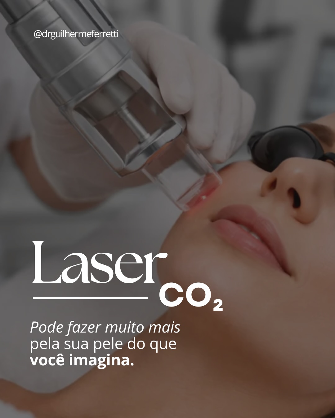 O laser CO₂ é muito mais do que um tratamento para rugas.
Quer saber se o laser CO₂ pode ser uma boa opção para você?
Agende sua avaliação.
Dr. Guilherme Ferretti | CRM 5288161-9
Agende uma consulta📲 (21) 99881-1411 ou link na bio
#drguilhermeferretti #cirurgiaplastica #estetica #laserco2 #laserco2rj