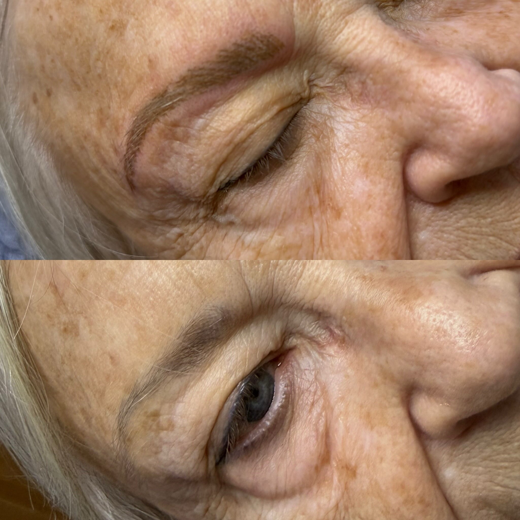 Love my Young At Heart clients! She had micro blading 14 years ago and still wanted hair strokes. Did quite a bit of soft pixelation throughout as well to help soften the strokes. These will lighten and soften beautifully♥️