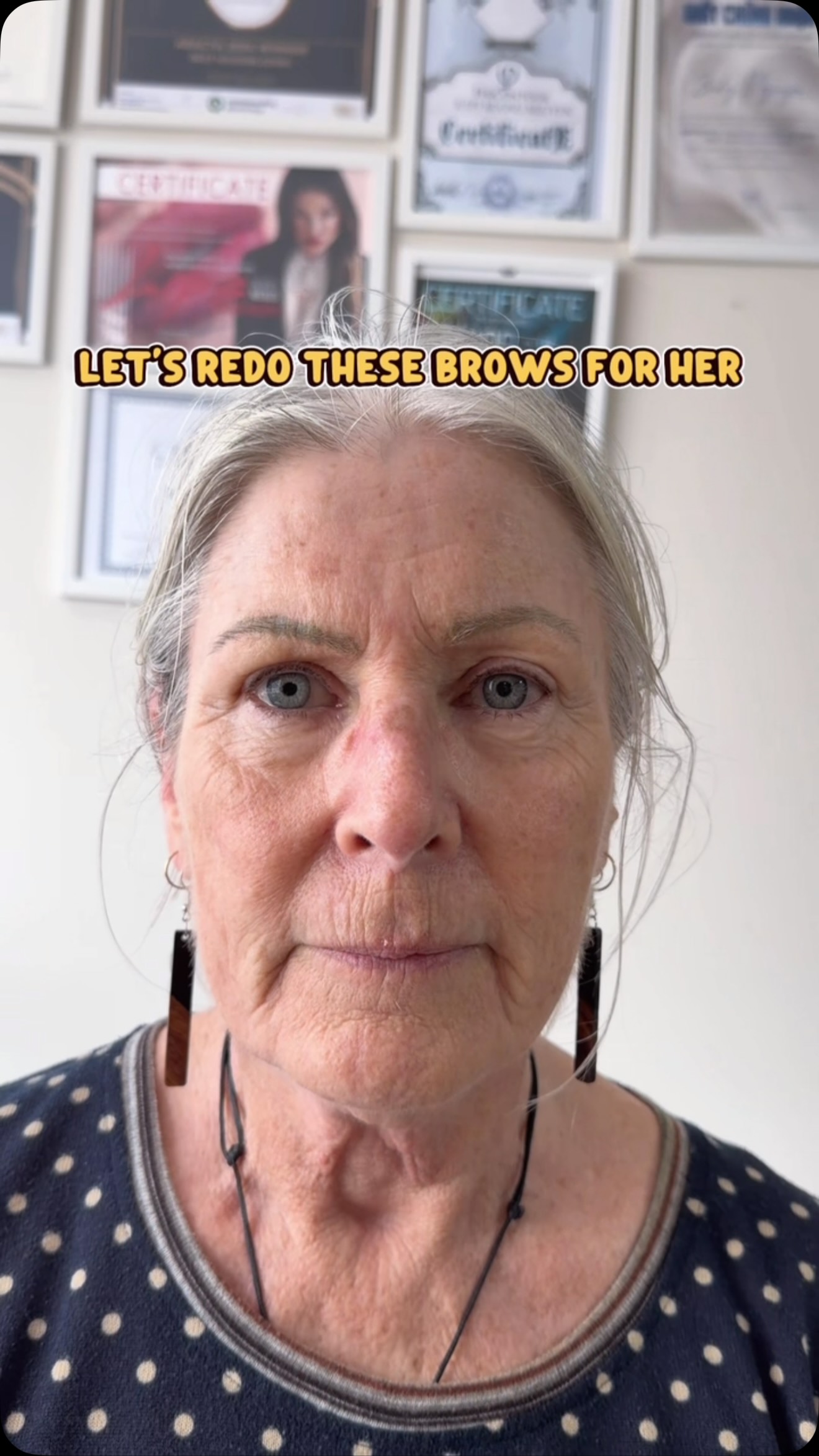 💁♀️if you have eyebrows done 10 years ago then your brows might be not balanced anymore!
Our face is changed over time and your brows might look uneven like this client!
Redo old dark tattoo brows start with laser removal is recommended!
📲 book online for free consultation