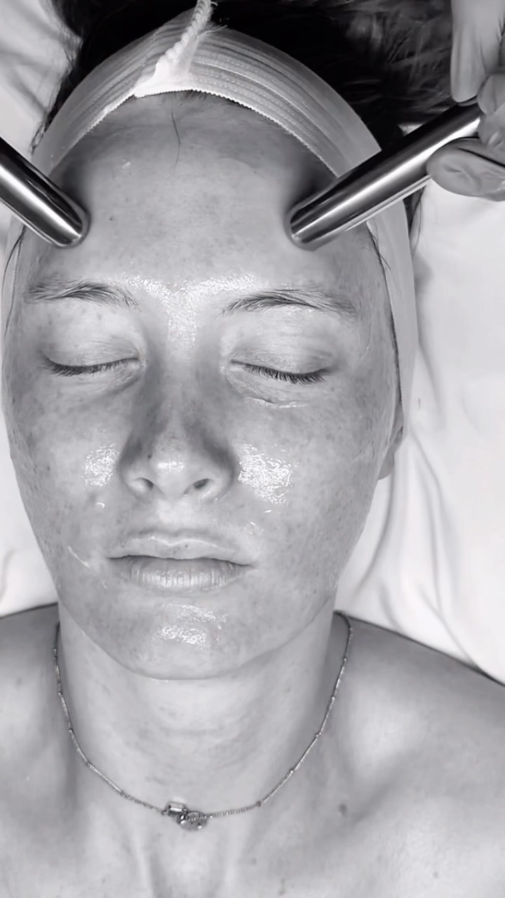 Two words… Cryo Globes 🙌🏻
Our September facial is all about redness relief. A restorative treatment created for skin that needs a little more calm.
Redness Relief pairs gentle hydration with intentional cooling techniques to soothe the appearance of visible redness and leave the complexion looking refreshed, balanced and beautifully restored.
Your treatment includes a double cleanse, gentle hydrating enzyme, custom serums, neck massage and a cooling cryo globe facial massage, designed to bring an elevated sense of calm to the skin.
Cool. Soothe. Restore.
Redness Relief is available throughout September at Onyx Med Spa.
Reserve your appointment now. ❤️