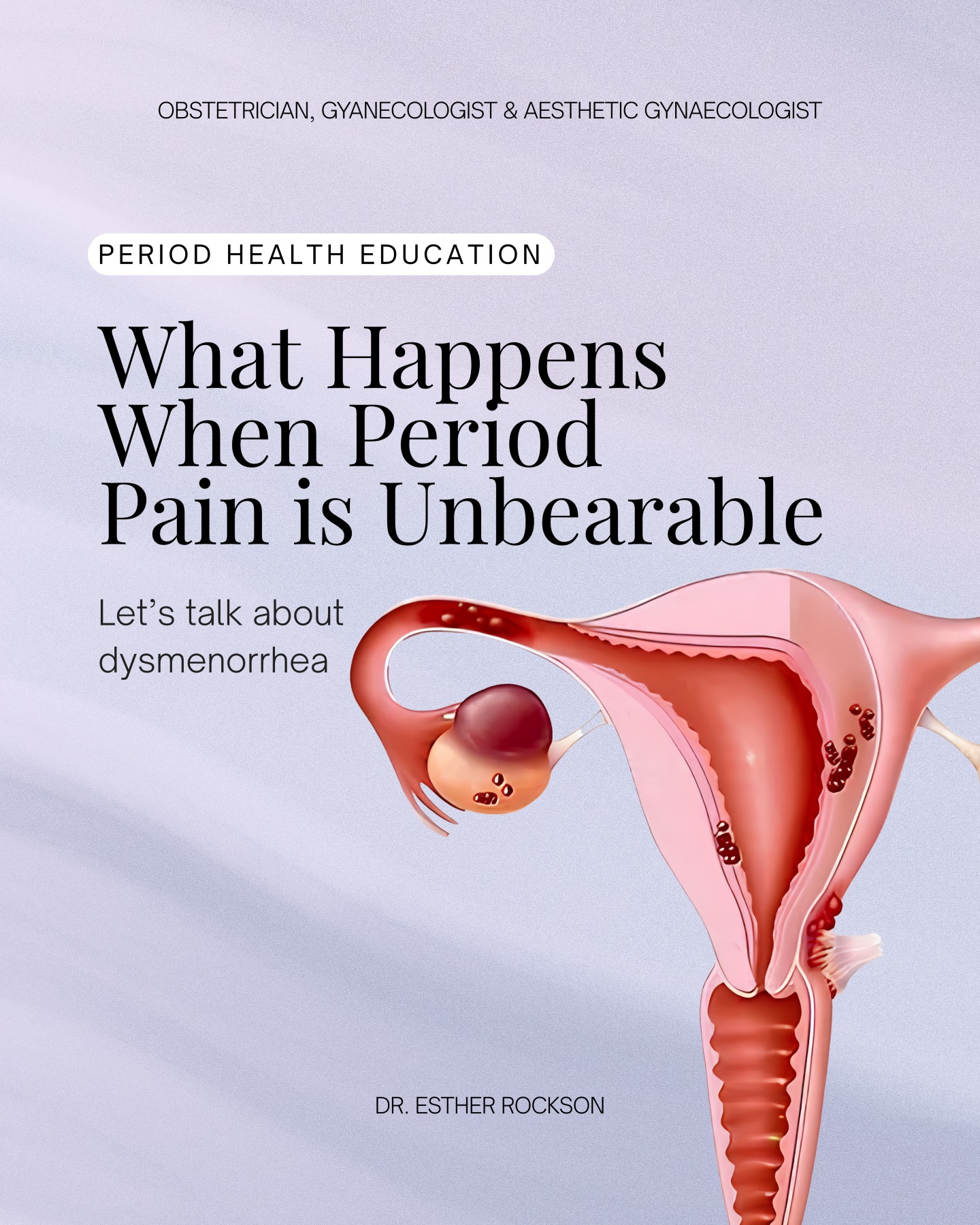 🩸 Dysmenorrhea: When Period Pain Becomes Too Much 🩸
Ladies, dysmenorrhea is that relentless, throbbing pain that radiates through your lower abdomen, back, and thighs. It strikes just before your period, peaks on days 1-2, and fades; but not for everyone.
For some, it’s a brief discomfort. For others, it's a torment that steals days each month. But could there be more than meets the eye? Conditions like endometriosis, adenomyosis, or fibroids might be lurking beneath the surface, making each cycle unbearable.
Treating the cause is the key to dealing with these excruciating period pains.
🔍 Ready to Break Free? Reach out if you experience:
😖 Pain that takes over your life every month.
😵💫 Agony that keeps getting worse over time.
🤯 Newly intense dysmenorrhea as an adult.
🤕 Pain so severe that you feel faint or can't stay conscious.
😓 Dysmenorrhea that lasts longer than 3 relentless days.
📍 Location:
Busamed Modderfontein Hospital
Suite No 5, Ground Floor
4 Cransley Crescent, Linbro Park
📞 Contact:
Tel: 011 458 2369
Email: busamed@docroc.co.za
#drestherrockson #drrocksonpractice #periodpains #dysmenorrhea