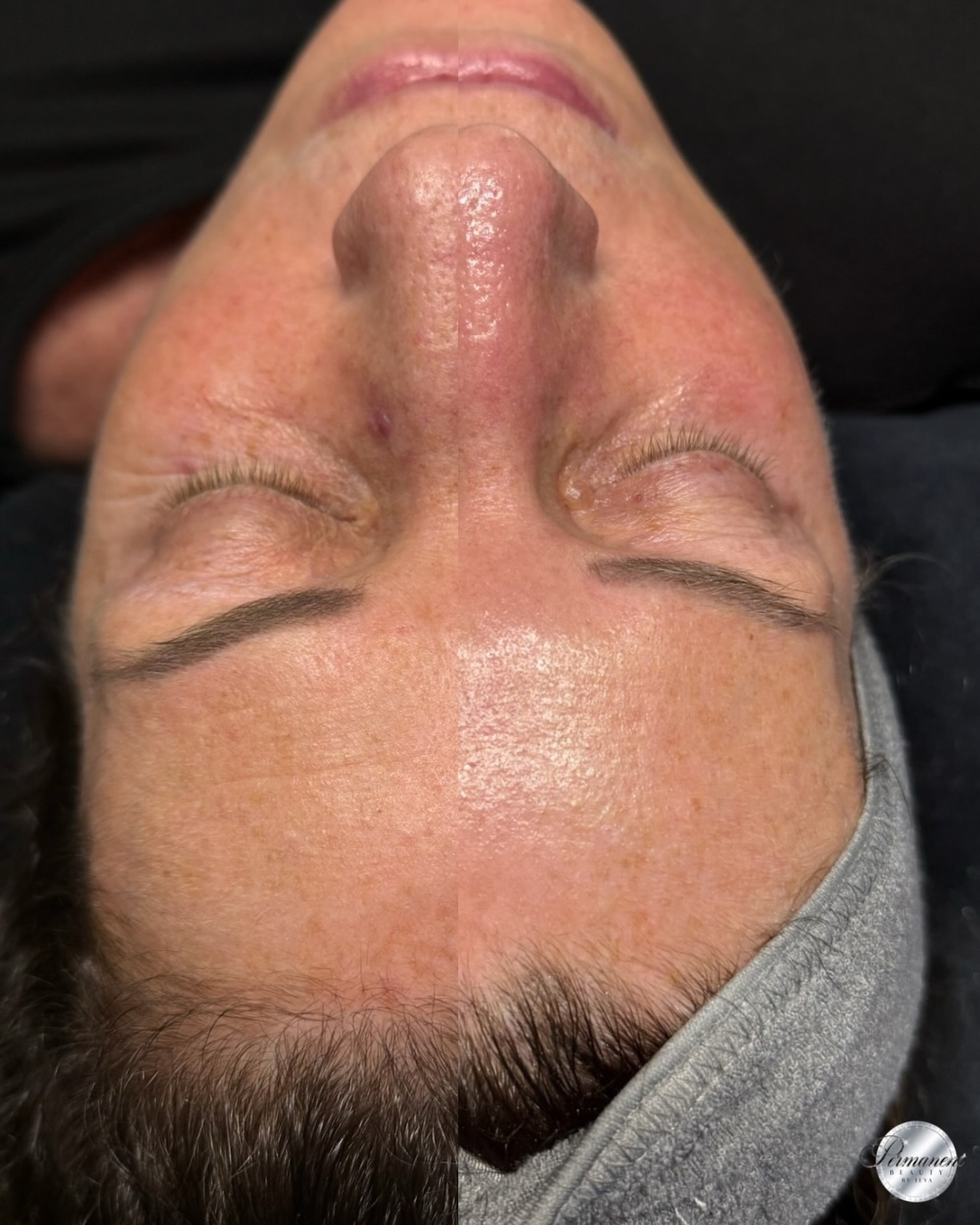 Carbon Peel is a great way to give your skin some extra care after the heat and strong summer sun ✨
It deeply cleanses, smooths the skin’s texture, minimizes the appearance of pores, and leaves you with a healthy, radiant glow.
A relaxing massage with creams or serums makes the treatment even more soothing. You can also pair it with our Luminous Lift Add-On for an extra boost of glow and longer-lasting results. Has no long downtime and visible results after just one session.
Fall is the perfect time to give your skin a full reset 🤍
Book your appointment with the link in BIO⬆️
____________________________________________________
Permanent Makeup Services, Tattoo Removal & Carbon Laser Facial
⬆️Book apt with the link in bio
✨Free Consultation available
📍Oshawa, Ontario
✉️ browsbyieva@gmail.com
📱 +1 416-804-6749
Website: permanentbeautybyieva.com
#carbonpeel #oshawafacials #whitbyfacials #oshawamedspa #oshawasalon