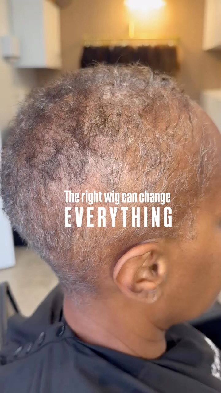 I mean… LOOK AT HER!!! 😍
There’s just something about finding the wig that makes you feel like you again.
Happy Wig Wednesday to all those who celebrate. 🤍
#wig #wigwednesday #hairlosscommunity #wigshop #alopecia