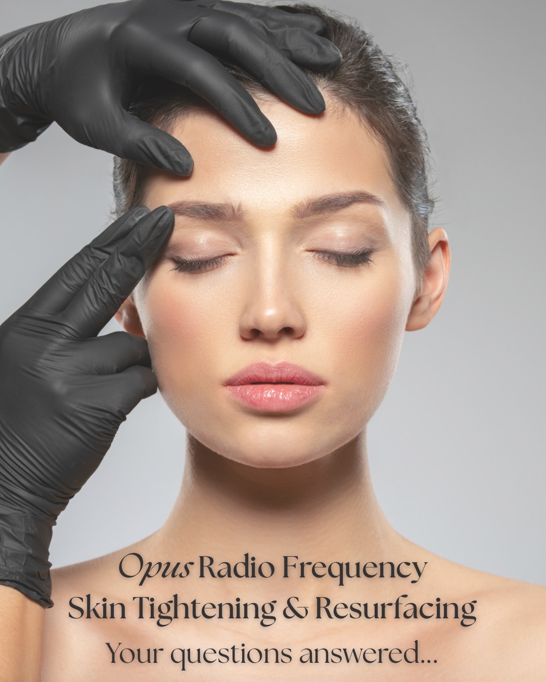 Can we really achieve amazing new skin without lasers? Yes we can!!
This is where Opus comes and why we fell in love with this machine.
Opus Radiofrequency uses heat and plasma energy to both tighten and resurface your skin with very little downtime in comparison to other treatments that offer the same outcomes.
We can treat targeted areas such as eyes (even eye lids), smokers lines, neck or full face and neck together. All treatments are completely tailored to your skin goals and areas of concern.
Not sure if this treatment is for you?
Book in for a in-depth consultation with our Skin Therapist for an open and honest chat and we will assess your skin with absolutely no obligation.
#bulimbaskinclinic #brisbaneskinclinic #radiofrequency #skintightening #resurfacingtreatment