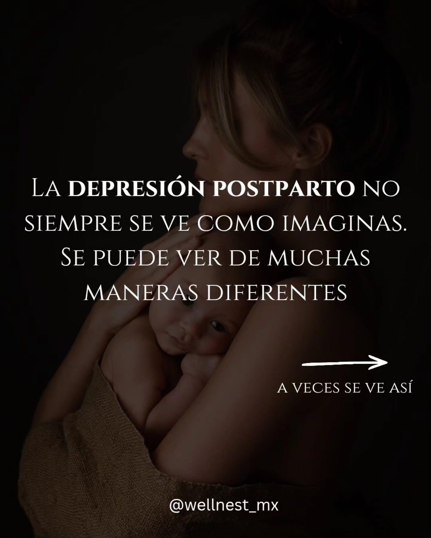 No toda mamá que sonríe está bien. 🤍
A veces la depresión posparto no se ve como tristeza. Puede sentirse como desconexión, agotamiento constante, ansiedad, pensamientos que no dan tregua o simplemente como sentir que ya no eres tú.
Y lo más difícil es que muchas mujeres siguen haciendo todo lo que “se supone” que deben hacer: cuidar a su bebé, cuidar de los demás, cumplir con el día a día… mientras por dentro están luchando en silencio.
No tienes que esperar a estar al límite para pedir ayuda.
Si algo de esto te resulta familiar, habla con alguien de confianza y busca apoyo profesional. Y si conoces a una mamá que podría estar pasando por esto, no tengas miedo de acercarte. A veces, un simple “¿cómo estás realmente?” puede ser el comienzo de algo muy importante. 🫂
Acompañar también es preguntar. Escuchar. No juzgar. Estar.
Guarda este post y compártelo con alguien que necesite leerlo hoy. 🤍
#DepresiónPosparto #SaludMentalMaterna #SaludMental #MaternidadReal #MaternidadSinFiltros Postparto MamáTambiénImporta AcompañamientoMaterno Psicología BienestarMaterno