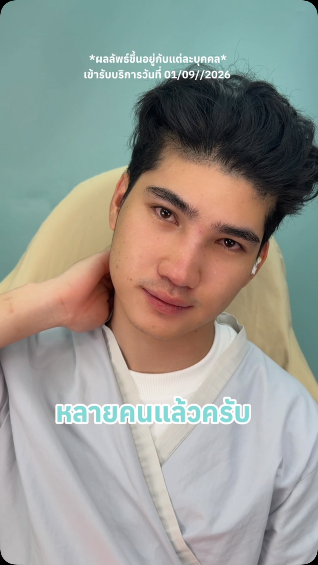 เพราะฉะนั้น❗️จะมาหล่อเหมือนกันไม่ได้ เพราะ #จำรูญคลินิก คำนึงถึงความเป็น unique ที่ครบทุกมิติ✨ #โปรแกรมเสริมจมูกกับคุณหมออุ๋มรุ่งทิวา #หมออุ๋มรุ่งทิวา #เสริมจมูกผู้ชาย #ทรงจมูกผู้ชาย