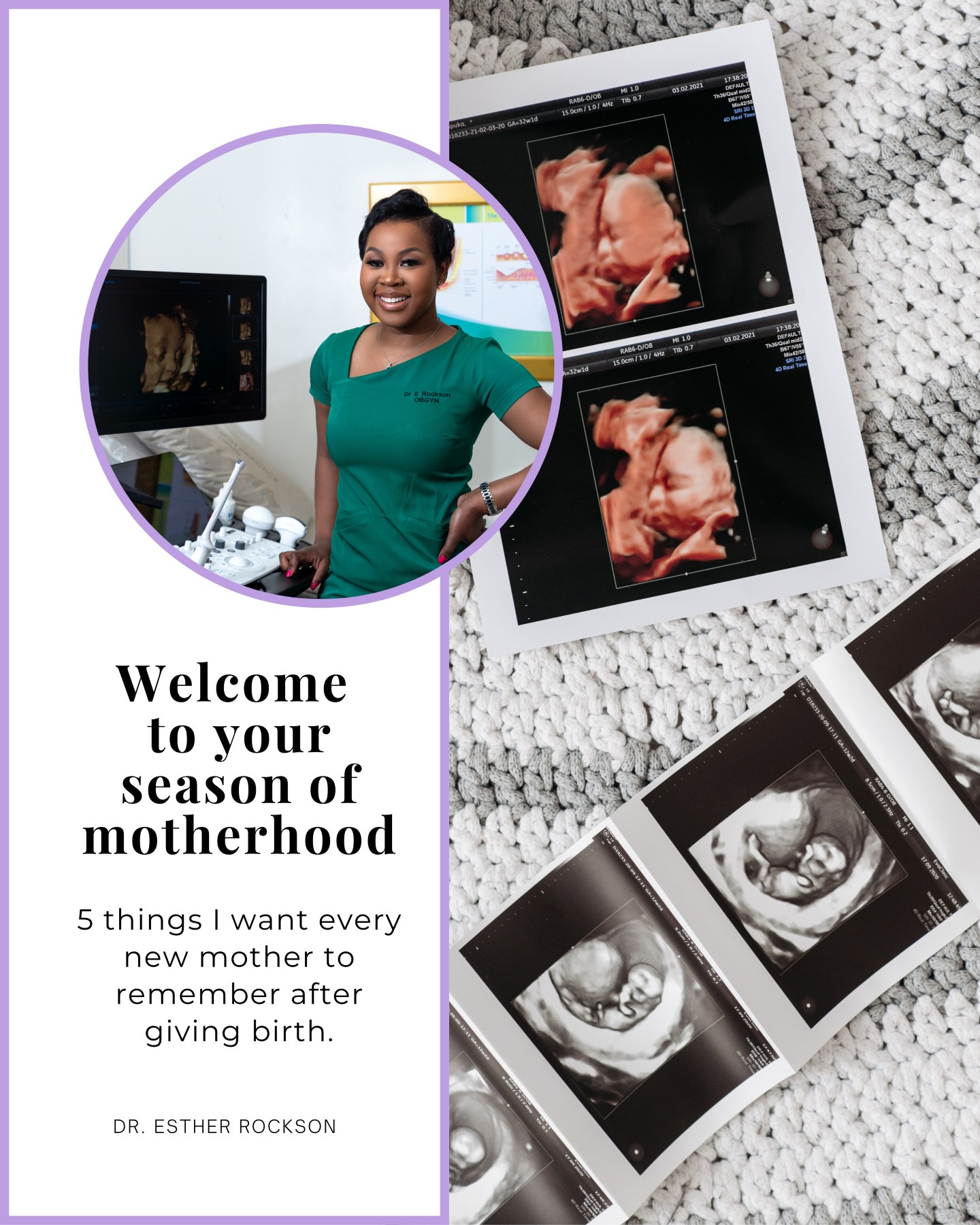 Welcome to your new season of motherhood, Mama💜
There will be a lot to remember once your bundle of joy arrives - and between the feeds, nappies, sleepless nights and getting to know this little person, you may forget a few things about you. So save this one and come back to it when you need it:
🤍 Your recovery matters too. Your baby needs care, but so do you.
🌿 Give your body time. It has carried and delivered a whole human being. Healing is a process.
🫶🏾 Your emotions matter. Postpartum isn't only a physical recovery. Pay attention to how you're feeling, too.
✨ You don't have to “bounce back.” There is no deadline for your body to look or feel a certain way after birth.
🩺 Please keep your postpartum appointment. It's your opportunity to check your recovery and talk about anything from breastfeeding and contraception to your physical and emotional wellbeing.
You may be a new mother, or a mother again; either way, every baby brings a new season. Welcome to yours.
Save this for later or share it with a mama who has just welcomed her little one.
📞 011 458 2369 | 011 458 2118
📧 busamed@docroc.co.za
📍 4 Cransley Crescent, Modderfontein
#drrockson #postpartumcare #motherhood #maternalhealth #womenshealth