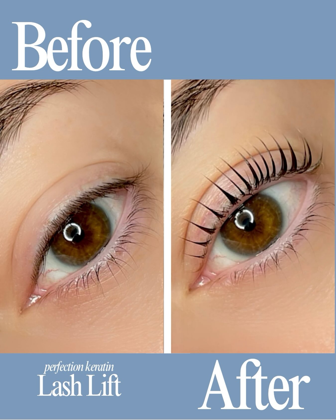 A little lift can make a BIG difference ✨
From straight & subtle to beautifully lifted, curled, and defined 🤍 Our lash lift enhances your natural lashes for a brighter, more open-eyed look—without extensions.
✨ Low-maintenance
✨ Effortless & natural-looking
✨ No lash curler needed
Your natural lashes, just elevated. 🤍
Ready to wake up with lashes like this? Book your lash lift with us!
📍345 Royal Hawaiian Avenue
🌐 remedyspahawaii.com
📧 info@remedyspahawaii.com
LINE: @018gsrrv
📞 English: (808) 762-0887
💬 Text & 日本語: (808) 208-3456
⋱⋰ ⋱⋰ ⋱⋰ ⋱⋰ ⋱⋰ ⋱⋰ ⋱⋰ ⋱⋰
新しいスパの形
レメディー(治療・改善)
New style of spa in Hawaii
Personalized remedies just for you
⋱⋰ ⋱⋰ ⋱⋰ ⋱⋰ ⋱⋰ ⋱⋰ ⋱⋰ ⋱⋰
#LashLiftHawaii #LashLiftHonolulu #WaikikiBeauty #NaturalLashes #RemedySpaHawaii