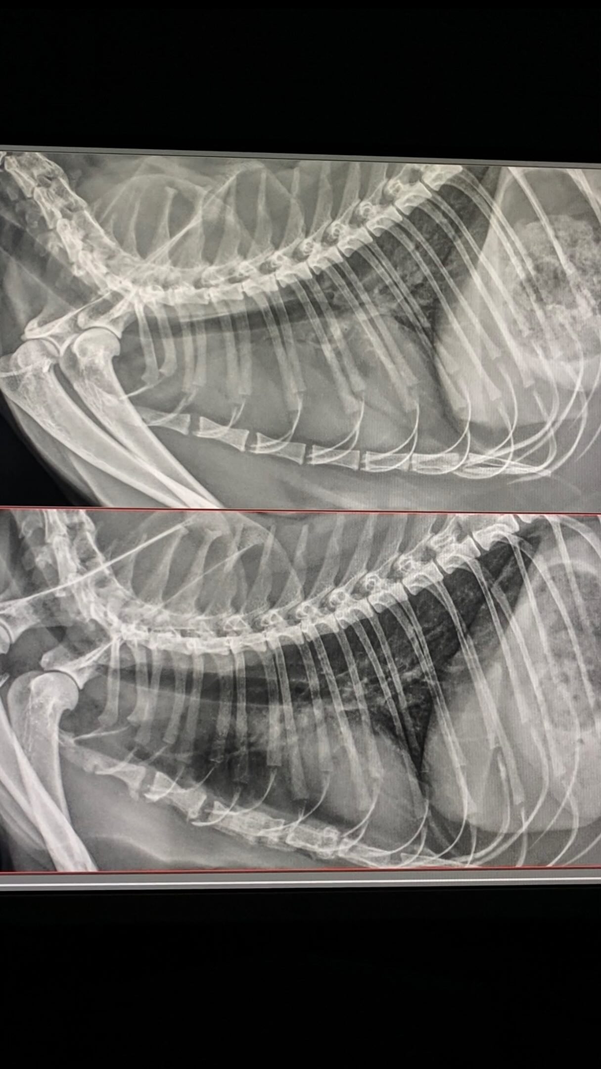 🐱✨ MIASTÈNIA GRAVIS SECUNDÀRIA A TIMOMA ✨🐱
Avui us volem presentar el cas de la Nan, una gateta molt, molt valenta. ❤️🐾
La miastènia gravis és una malaltia neuromuscular en què els anticossos interfereixen en la transmissió de l’impuls nerviós cap als músculs, provocant debilitat muscular. En alguns casos, aquesta malaltia pot estar associada a un timoma, un tumor del timus, com en el cas de la Nan. 🧠💪
La Nan és una gateta siamesa de 9 anys que va arribar a consulta amb signes neurològics, inclinació del cap, apatia, anorèxia i una debilitat molt marcada, fins al punt que gairebé no es podia moure. 😿
Les proves d’imatge van permetre detectar una massa dins del tòrax. 🩻 Vam decidir intervenir quirúrgicament i extirpar-la mitjançant una esternotomia. 🩺✨
Després de la cirurgia, es va iniciar el tractament per a la miastènia gravis i la Nan va estar uns dies hospitalitzada. L’evolució dels signes neurològics va ser espectacular. ❤️🩹
Al cap d’aproximadament un mes, els símptomes havien desaparegut gairebé completament. 🥹🐾
I quatre mesos després… control radiològic sense rastre del tumor i amb tota la medicació retirada. 🎉✨
La Nan està d'allò més bé! ❤️🐱
És un d’aquells casos que ens recorden que trobar un tumor al tòrax no sempre significa que tot estigui perdut. A vegades, amb un diagnòstic i un tractament adequats, podem aconseguir una recuperació espectacular. 🙏🏻💪
Estem súper contents amb l’evolució de la Nan i esperem que continuï així durant molt de temps. 🥰🐾
Un cas molt especial que ens ha fet molta il·lusió compartir amb vosaltres. ❤️
#TeamBestiari #Bestiari #Veterinària #MedicinaVeterinària #MedicinaFelina Gats Siamès MiastèniaGravis Timoma NeurologiaVeterinària OncologiaVeterinària CirurgiaVeterinària CasClínic VeterinaryMedicine CatMedicine