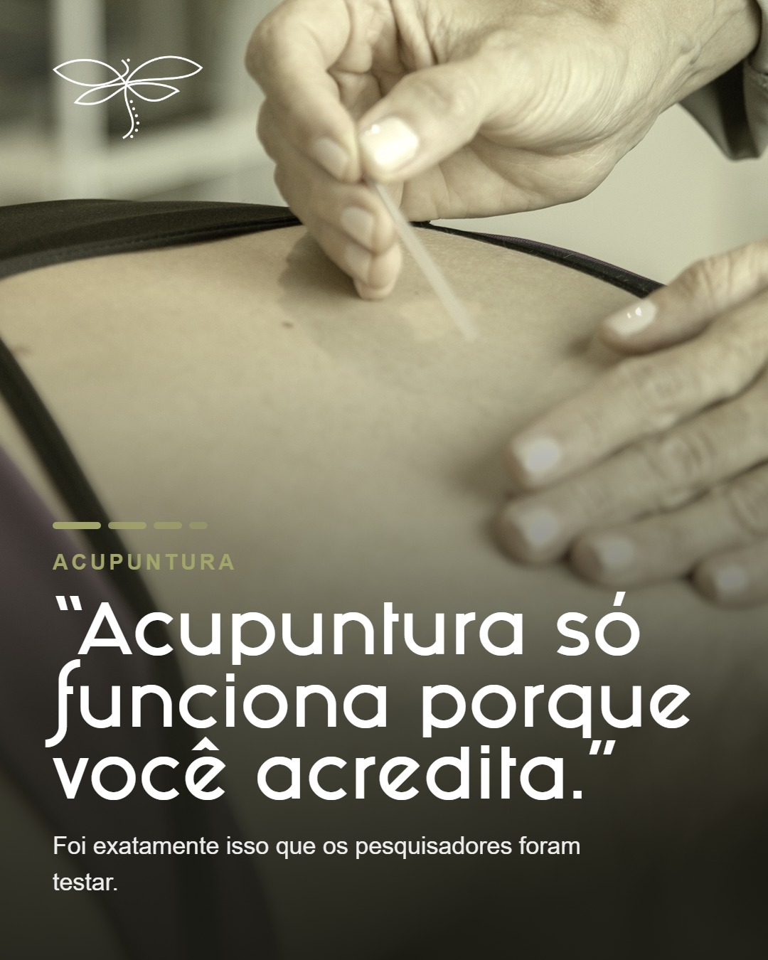 "Acupuntura é sugestão: funciona na cabeça."
Você provavelmente já ouviu isso. Ou já pensou.
E é uma dúvida honesta: dor é pessoal, e o que a gente espera sentir mexe com o que a gente sente. Só que essa pergunta já foi levada a sério. Compararam quem recebeu a agulha de verdade com quem recebeu uma aplicação simulada, acreditando igual.
Quem recebeu a de verdade melhorou mais não por muito, mas melhorou e a melhora seguia lá cerca de um ano depois.
Efeito menor não é efeito nenhum. Para quem convive com dor há anos, uma redução que se sustenta no tempo muda o dia. Mas não é cura, não tem prazo e não tem número mágico de sessões.
A evidência é mais consistente em dor de articulação, dor de
cabeça repetida e dor muscular de longa data. Se é o seu caso, vale avaliar, com acompanhamento certo pro seu quadro.
Agende sua avaliação e vamos entender qual é a sua dor.
📍 Clínica Lorem - Itajaí
Dra. Ana Ligia Oliveira · Acupuntura
#dorcronica #acupuntura #fisioterapia #dornascostas
#clinicalorem #itajai #saudebaseadaemevidencia