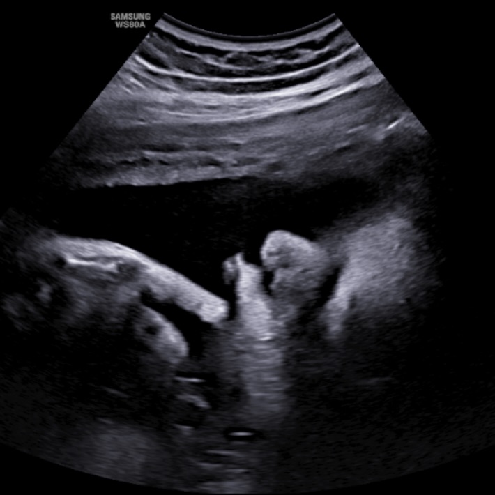Safe to say she was over it! 😂✌️
#37weeks
