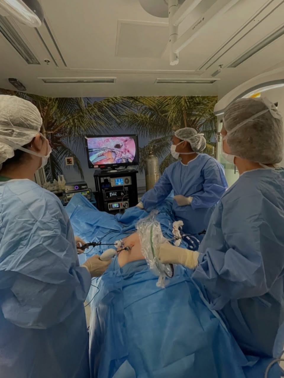 #equipeCOP em procedimento de cirurgia redutora de risco em paciente com histórico de câncer de mama bilateral e mutação genética associada a maior risco para outros tumores, incluindo o câncer de ovário.
Foi realizada histerectomia total com retirada dos ovários e das tubas uterinas por laparoscopia.
🧬 Em pacientes com alterações genéticas que aumentam significativamente o risco de determinados tipos de câncer, a cirurgia redutora de risco pode ser uma estratégia de prevenção.
🧬 A indicação desse tipo de cirurgia é individualizada e considera fatores como o gene envolvido, o risco de câncer, histórico pessoal e familiar, idade e desejo reprodutivo.
Em ação a cirurgiã oncológica Dra. Christine Miranda com a Dra. Luciana Walter, Dra. Simone Barros e Tayza Carla na instrumentação.
🤝 conte com a COP.