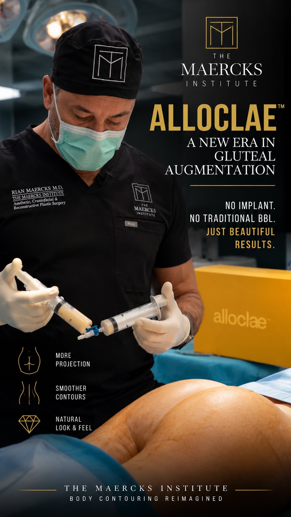 🍑 300 CCs OF GLUTEAL AUGMENTATION. NO IMPLANT. NO TRADITIONAL BBL.
A different kind of OR day at The Maercks Institute.
Meet AlloClae™, an adipose-derived structural tissue product that opens an exciting option for patients seeking gluteal enhancement without an implant or traditional fat-transfer BBL.
This patient had previously tried a smaller amount and came back wanting a more meaningful result.
This time: 150 cc per side.
But the goal isn’t simply a bigger butt.
It’s better geometry.
Dr. Rian A. Maercks strategically uses the volume to:
✨ Increase projection
✨ Round the gluteal silhouette
✨ Soften hip dips
✨ Improve asymmetries
✨ Refine the infragluteal crease
✨ Better define where the buttock begins and ends
Dr. Maercks has also developed his own approach to delivery, incorporating principles from the Exparel tumescent technique used throughout surgery at The Maercks Institute, with the goals of comfort, smooth distribution and thoughtful tissue integration.
Her verdict?
“Fantastic.”
A little nitrous. Local anesthesia. Long-acting analgesia.
And immediately afterward, a rounder, more projecting and clearly defined silhouette.
For selected patients who don’t want an implant, or may not have sufficient donor fat for traditional fat transfer, AlloClae creates an intriguing new possibility.
Not simply more volume.
Better shape. Better proportion. Better balance. 🍑
Interested?
DM “ALLOCLAE” to The Maercks Institute to learn whether you’re a candidate.
#AlloClae #GlutealAugmentation #BodyContouring #HipDips #TheMaercksInstitute