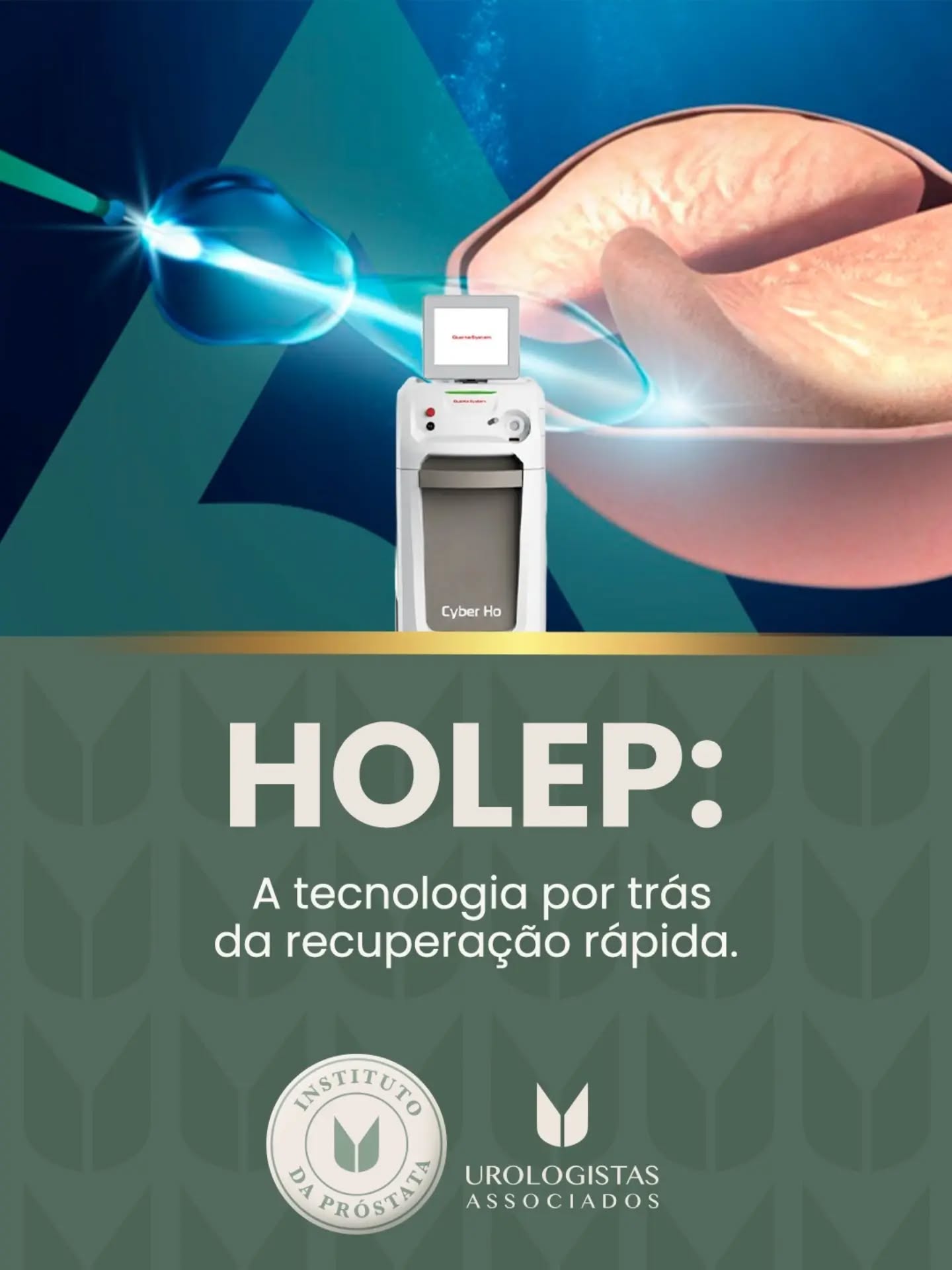 O poder da tecnologia a laser está mudando a forma como tratamos a saúde urológica. 🔬✨
Quando o aumento benigno da próstata começa a dar sinais, como jato urinário fraco, dificuldade para urinar e idas constantes ao banheiro 🚻, a precisão faz toda a diferença.
Em casos indicados, o HoLEP utiliza um laser de alta potência ⚡ para remover o tecido prostático que obstrui a passagem da urina, de forma minimamente invasiva e sem cortes externos.
É uma alternativa moderna e altamente eficaz para o tratamento da hiperplasia prostática benigna. ✅
No Instituto da Próstata, cada caso é avaliado individualmente 👨⚕️ para definir a melhor abordagem para o seu bem-estar.
📲 Agende sua avaliação: (34) 3219-7777
#HoLEP #HiperplasiaProstaticaBenigna #ProstataAumentada #SaudeDoHomem #SaudeUrologica