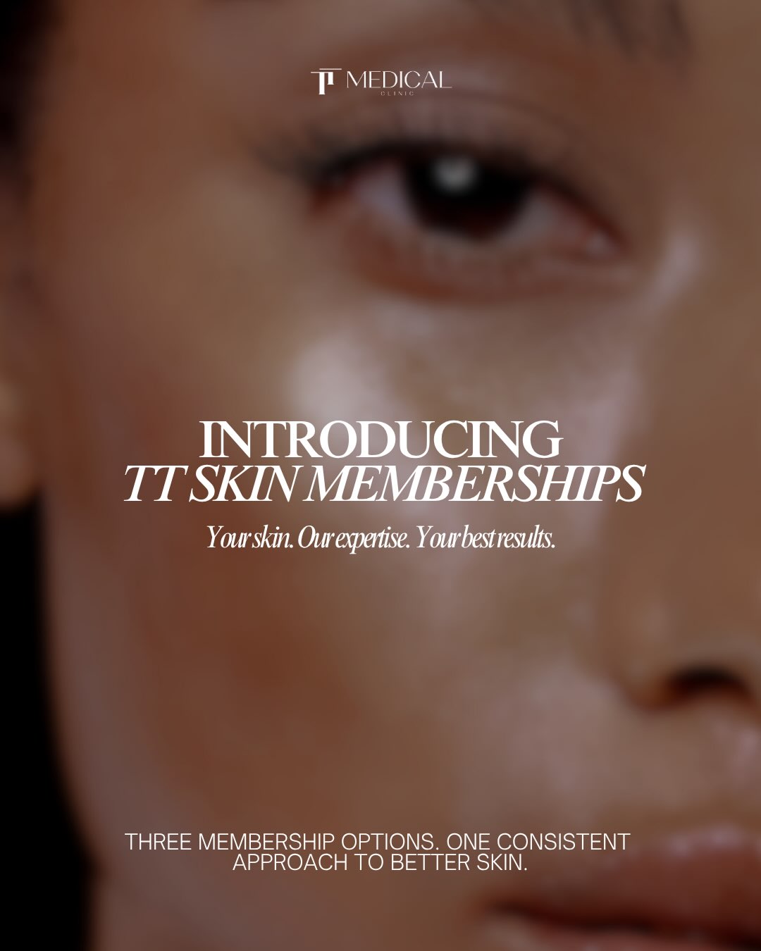 Unofficial skin treatment season has officially started… and we’ve made staying consistent with your skin a whole lot easier. 🤎
Introducing TT Skin Memberships, three levels of personalised skin care, designed around one thing: getting you better results through consistency.
Instead of paying for your treatments all at once, your membership is paid by monthly direct debit across the year, giving you a structured treatment plan to work through with us while making the cost feel much more manageable month to month.
Think regular skin analysis, professional treatments, regenerative options and exclusive savings on your medical-grade skincare, with our team keeping an eye on your skin and adjusting your plan as it changes.
Because good skin isn’t usually the result of one appointment. It’s what happens when we assess, treat, review and stay consistent. ✨
Swipe through to meet Essential, Refine + Elite and see which level feels right for you.
Not sure where you sit? DM “SKIN” and we’ll help you choose the membership that best suits your skin, concerns and goals. 🤍