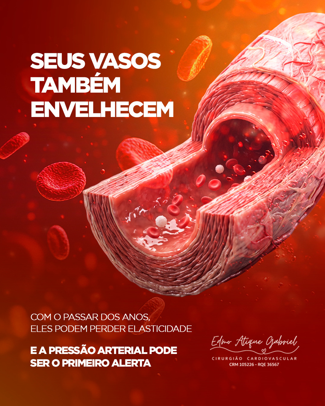 O envelhecimento faz parte da vida. Mas você sabia que ele também provoca mudanças nos nossos vasos sanguíneos?
Com o passar dos anos, as artérias podem perder parte da sua elasticidade por causa de alterações na parede vascular e de processos inflamatórios.
Esse processo acontece de forma silenciosa e pode contribuir para o aumento da pressão arterial.
Quando a hipertensão não é identificada e controlada, o risco de complicações importantes aumenta, como infarto, AVC e insuficiência renal.
Por isso, acompanhar a pressão arterial não deve ser uma preocupação apenas quando os sintomas aparecem.
🫀 Quanto mais cedo identificamos a hipertensão, maiores são as possibilidades de controlar seus efeitos e proteger o coração e os vasos sanguíneos.
Prevenção começa antes do problema aparecer.
#SaúdeDoCoração #Hipertensão #PressãoArterial #SaúdeCardiovascular #Cardiologia #Prevenção #EnvelhecimentoSaudável #CoraçãoSaudável #Infarto #AVC #InsuficiênciaRenal #CheckUpCardiológico #CuideDoSeuCoração